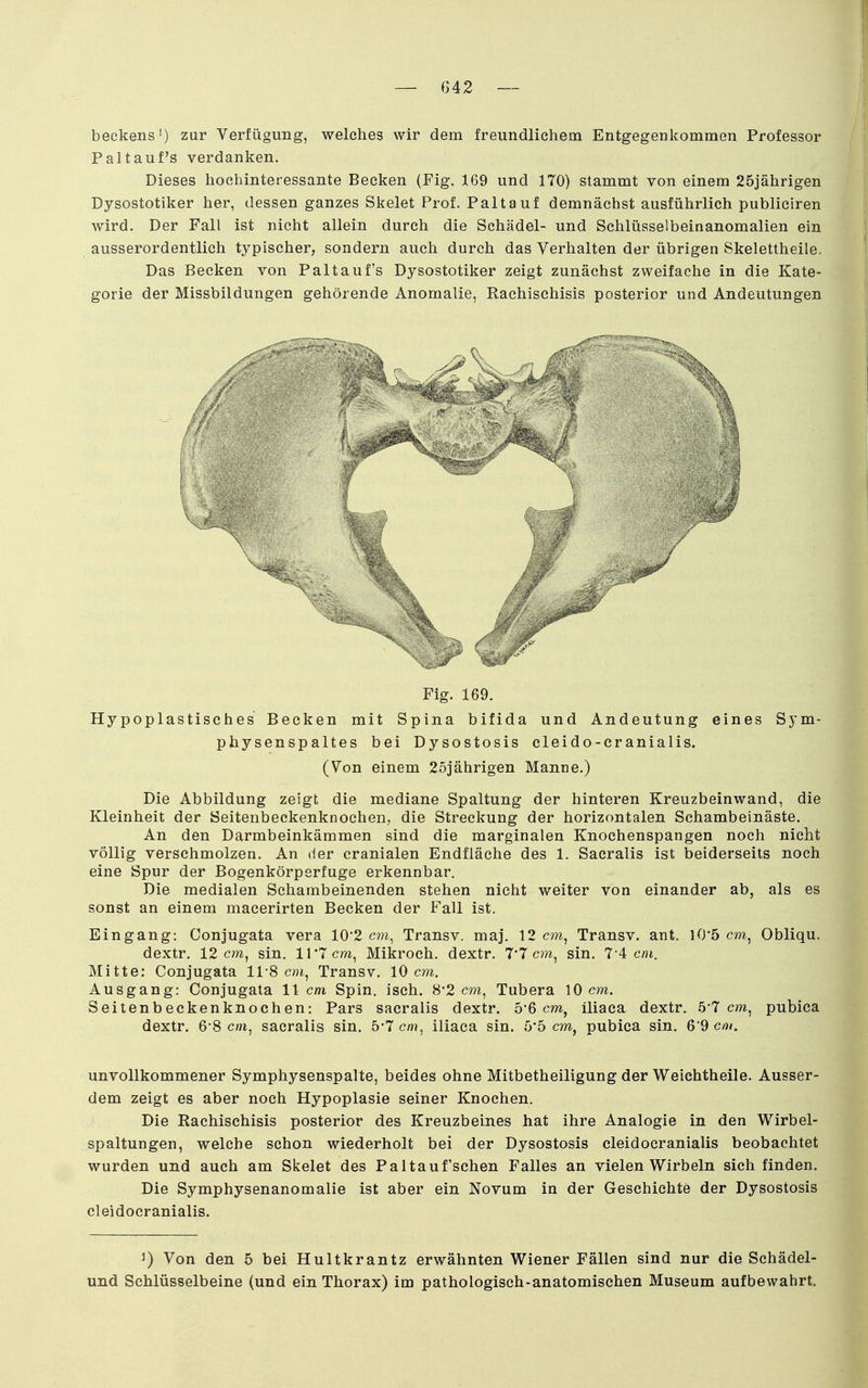 beckens') zur Verfügung, welches wir dem freundlichem Entgegenkommen Professor Paltauf's verdanken. Dieses hochinteressante Becken (Fig. 169 und 170) stammt von einem 25jährigen Dysostotiker her, dessen ganzes Skelet Prof. Paltauf demnächst ausführlich publiciren wird. Der Fall ist nicht allein durch die Schädel- und Schlüsselbeinanomalien ein ausserordentlich typischer, sondern auch durch das Verhalten der übrigen Skelettheile. Das Becken von Paltauf's Dysostotiker zeigt zunächst zweifache in die Kate- gorie der Missbildungen gehörende Anomalie, Rachischisis posterior und Andeutungen Fig. 169. Hypoplastisches Becken mit Spina bifida und Andeutung eines Sym- physenspaltes bei Dysostosis cleido-cranialis. (Von einem 25jährigen Manne.) Die Abbildung zeigt die mediane Spaltung der hinteren Kreuzbeinwand, die Kleinheit der Seitenbeckenknochen, die Streckung der horizontalen Schambeinäste. An den Darmbeinkämmen sind die marginalen Knochenspangen noch nicht völlig verschmolzen. An der cranialen Endfläche des 1. Sacralis ist beiderseits noch eine Spur der Bogenkörperfuge erkennbar. Die medialen Schambeinenden stehen nicht weiter von einander ab, als es sonst an einem macerirten Becken der Fall ist. Eingang: Conjugata vera 10'2 cm, Transv. maj. 12 cm, Transv. ant. 10-5 cm, Obliqu. dextr. 12 cm, sin. ll'Tcw, Mikroch. dextr. 7*7 c?w, sin. 7-4 cm. Mitte: Conjugata 11-8 cm, Transv. 10 cm, Ausgang; Conjugata 11 cm Spin. isch. 8'2 cm, Tubera 10 cm. Seitenbeckenknochen: Pars sacralis dextr. o'6 cm, iliaca dextr. 5'7 cm, pubica dextr. 6-8 cm, sacralis sin. 5-7 cm, iliaca sin. 5*5 cm, pubica sin. 6'9 cm. unvollkommener Symphysenspalte, beides ohne Mitbetheiligung der Weichtheile. Ausser- dem zeigt es aber noch Hypoplasie seiner Knochen. Die Rachischisis posterior des Kreuzbeines hat ihre Analogie in den Wirbel- spaltungen, welche schon wiederholt bei der Dysostosis cleidocranialis beobachtet wurden und auch am Skelet des Paltaufschen Falles an vielen Wirbeln sich finden. Die Symphysenanomalie ist aber ein Novum in der Geschichte der Dysostosis cleidocranialis. 1) Von den 5 bei Hultkrantz erwähnten Wiener Fällen sind nur die Schädel- und Schlüsselbeine (und ein Thorax) im pathologisch-anatomischen Museum aufbewahrt.