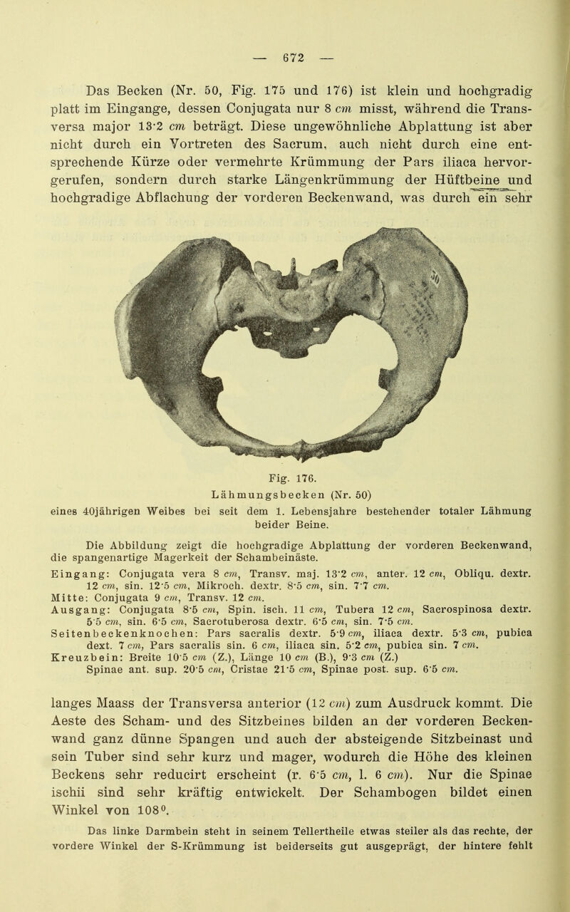 Das Becken (Nr. 50, Fig. 175 und 176) ist klein und hochgradig platt im Eingange, dessen Conjugata nur 8 cm misst, während die Trans- versa major 13*2 cm beträgt. Diese ungewöhnliche Abplattung ist aber nicht durch ein Vortreten des Sacrum, auch nicht durch eine ent- sprechende Kürze oder vermehrte Krümmung der Pars iliaca hervor- gerufen, sondern durch starke Längenkrümmung der Hüftbeine und hochgradige Abflachung der vorderen Beckenwand, was durch ein sehr Fig. 176. Lähmungsbecken (Nr. 50) eines 40jährigen Weibes bei seit dem 1. Lebensjahre bestehender totaler Lähmung beider Beine. Die Abbildung- zeigt die hochgradige Abplattung der vorderen Beckenwand, die spangenartige Magerkeit der Schambeinäste. Eingang: Conjugata vera 8 cm, Transr. maj. 13'2 cm, anter. 12 c»i, Obliqu. dextr. 12 cm, sin. 12'5 cm, Mikroch. dextr. 8'5 cm, sin. 7'7 cm. Mitte: Conjugata 9 cm, Transv. 12 cm. Ausgang: Conjugata 8-5 cni, Spin. isch. 11 cm, Tubera 12 cm, Saerospinosa dextr. 5'5 cm, sin. 65 cm, Saerotuberosa dextr. 6'5 cm, sin. 7*5 cm. Seitenbeckenknoehen: Pars sacralis dextr. 5'9 cm, iliaca dextr. 53 cm, pubica dext. 7 cm, Pars sacralis sin. 6 cm, iliaca sin. 5'2 cm, pubica sin. 7 cm. Kreuzbein: Breite 10'5 cm (Z.), Länge 10 cm (B.), 9*3 cm (Z.) Spinae ant. sup. 20-5 cm, Cristae 21*5 cm, Spinae post. sup. 65 cm. langes Maass der Transversa anterior (12 cm) zum Ausdruck kommt. Die Aeste des Scham- und des Sitzbeines bilden an der vorderen Becken- wand ganz dünne Spangen und auch der absteigende Sitzbeinast und sein Tuber sind sehr kurz und mager, wodurch die Höhe des kleinen Beckens sehr reducirt erscheint (r. 6'5 cm, 1. 6 cm). Nur die Spinae ischii sind sehr kräftig entwickelt. Der Schambogen bildet einen Winkel von 108 o. Das linke Darmbein steht in seinem Tellertheile etwas steiler als das rechte, der vordere Winkel der S-Krümmung ist beiderseits gut ausgeprägt, der hintere fehlt