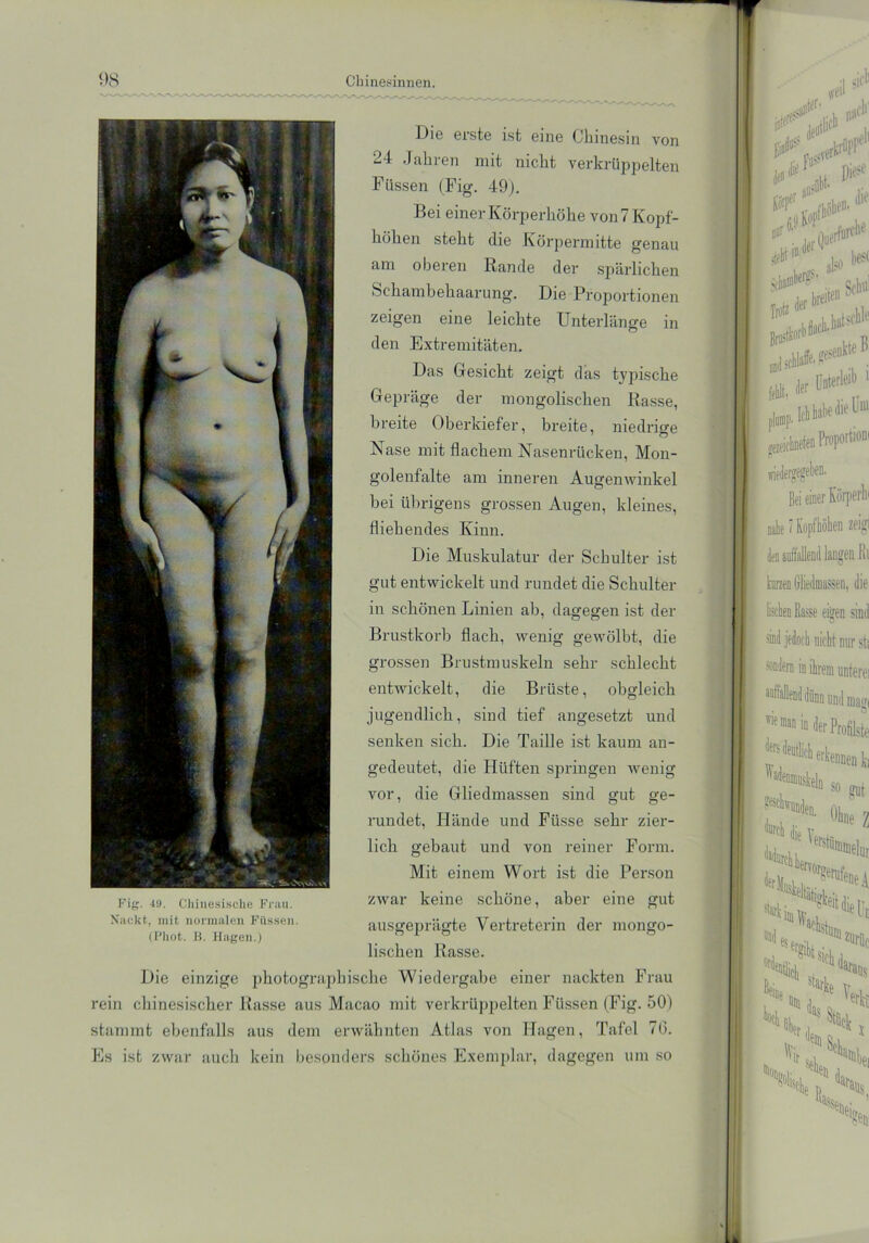 Fig. 49. Chinesische Frau. Nackt, mit normalen Füssen. (Phot. B. Hagen.) Unterlänge O Die erste ist eine Chinesin von 24 Jahren mit nicht verkrüppelten Füssen (Fig. 49). Bei einer Körperhöhe von 7 Kopf- höhen steht die Körpermitte genau am oberen Rande der spärlichen Schambehaarung. Die Proportionen zeigen eine leichte den Extremitäten. Das Gesicht zeigt das typische Gepräge der mongolischen Rasse, breite Oberkiefer, breite, niedrige Nase mit flachem Nasenrücken, Mon- golenfalte am inneren Augenwinkel bei übrigens grossen Augen, kleines, fliehendes Kinn. Die Muskulatur der Schulter ist gut entwickelt und rundet die Schulter in schönen Linien ab, dagegen ist der Brustkorb flach, wenig gewölbt, die grossen Brustmuskeln sehr schlecht entwickelt, die Brüste, obgleich jugendlich, sind tief angesetzt und senken sich. Die Taille ist kaum an- gedeutet, die Hüften springen wenig vor, die Gliedmassen sind gut ge- rundet, Hände und Fiisse sehr zier- lich gebaut und von reiner Form. Mit einem Wort ist die Person zwar keine schöne, aber eine gut ausgeprägte Vertreterin der mongo- lischen Rasse. Die einzige photographische Wiedergabe einer nackten Frau rein chinesischer Rasse aus Macao mit verkrüppelten Füssen (Fig. 50) stammt ebenfalls aus dem erwähnten Atlas von Hagen, Tafel 76. Es ist zwar auch kein besonders schönes Exemplar, dagegen um so