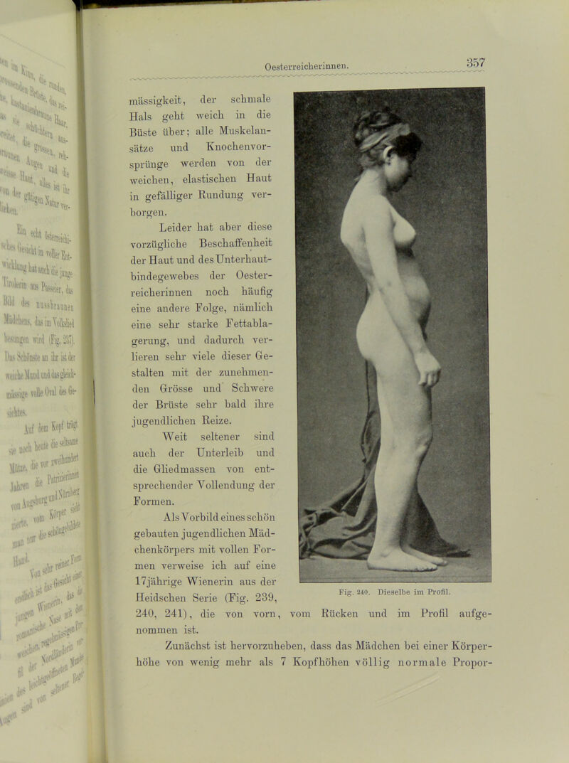 mässigkeit, der schmale Hals geht weich in die Büste über; alle Muskelan- sätze und Knochenvor- sprünge werden von der weichen, elastischen Haut in gefälliger Rundung ver- borgen. Leider hat aber diese vorzügliche Beschaffenheit der Haut und des Unterhaut- bindegewebes der Oester- reicherinnen noch häufig eine andere Folge, nämlich eine sehr starke Fettabla- gerung, und dadurch ver- lieren sehr viele dieser Ge- stalten mit der zunehmen- den Grösse und Schwere der Brüste sehr bald ihre jugendlichen Reize. Weit seltener sind auch der Unterleib und die Gliedmassen von ent- sprechender Vollendung der Formen. Als Vorbild eines schön gebauten jugendlichen Mäd- chenkörpers mit vollen For- men verweise ich auf eine 17jährige Wienerin aus der Heidschen Serie (Fig. 239, 240, 241), die von vorn, nommen ist. Zunächst ist hervorzuheben, dass das Mädchen hei einer Körper- höhe von wenig mehr als 7 Kopf höhen völlig normale Propor- Fig. 240. Dieselbe im Profil. vom Rücken und im Profil aufge-