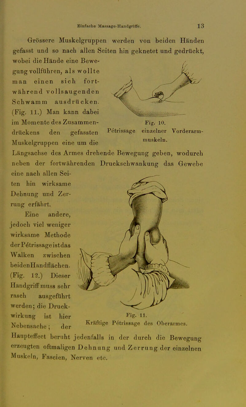 Fig. 10. Pi'trissage einzelner Vorderarm- muskeln. Grössere Muskelgruppen werden von beiden Händen gefasst und so nach allen Seiten hin geknetet und gedrückt, wobei die Hände eine Bewe- gung vollführen, als wollte man einen sich fort- während vollsaugenden Schwamm ausdrücken. (Fig. 11.) Man kann dabei im Momente des Zusammen- drückens den gefassten Muskelgruppen eine um die Längsachse des Armes drehende Bewegung geben, wodurch neben der fortwährenden Druckschwankung das Gewebe eine nach allen Sei- ten hin wirksame Dehnung und Zer- rung erfährt. Eine andere, jedoch viel weniger wirksame Methode derP&rissageistdas Walken zwischen beidenHandflächen. (Fig. 12.) Dieser Handgriff muss sehr rasch ausgeführt werden; die Druck- wirkung ist hier Nebensache; der Haupteffect beruht jedenfalls in der durch die Bewegung erzeugten oftmaligen Dehnung und Zerrung der einzelnen Muskeln, Fascien, Nerven etc. Fig. ll. Krüftige Pe^rissage des Oberarmes.