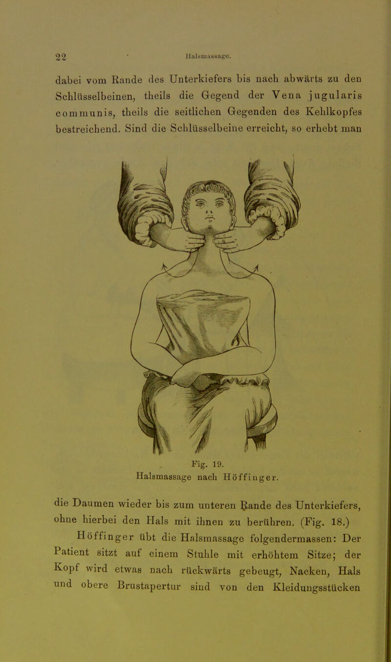 dabei vom Rande des Unterkiefers bis nach abwärts zu den Schlüsselbeinen, theils die Gegend der Vena jugularis communis, theils die seitlichen Gegenden des Kehlkopfes bestreichend. Sind die Schlüsselbeine erreicht, so erhebt man Fig. 19. Halsma8sage nach Höf fing er. die Daumen wieder bis zum unteren Rande des Unterkiefers, ohne hierbei den Hals mit ihnen zu berühren. (Fig. 18.) Höffinger übt die Halsmassage folgendermassen: Der Patient sitzt auf einem Stuhle mit erhöhtem Sitze; der Kopf wird etwas nach rückwärts gebeugt, Nacken, Hals und obere Brustapertur sind von den Kleidungsstücken