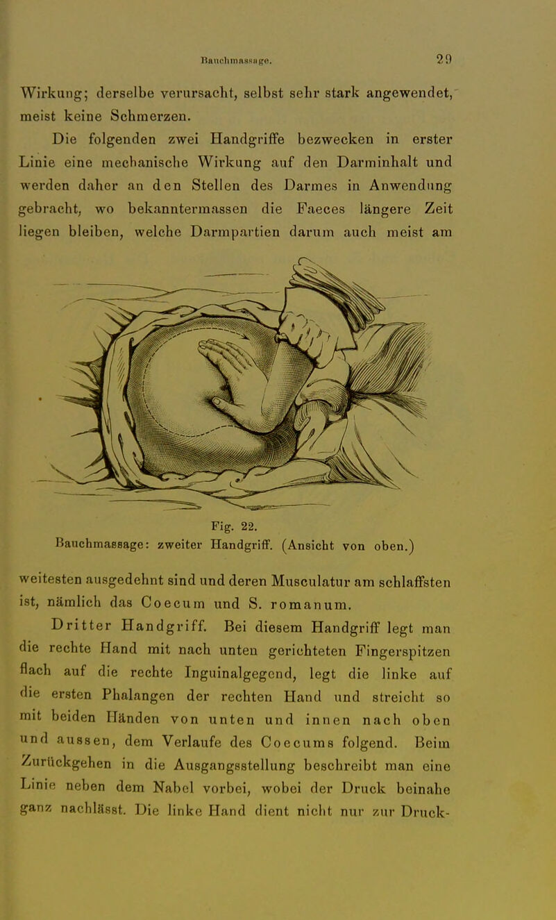 BauclurinHxii 21) Wirkung; derselbe verursacht, selbst sehr stark angewendet, meist keine Schmei-zen. Die folgenden zwei Handgriffe bezwecken in erster Linie eine mechanische Wirkung auf den Darminhalt und werden daher an den Stellen des Darmes in Anwendung gebracht, wo bekanntermassen die Faeces längere Zeit liegen bleiben, welche Darmpartien darum auch meist am Fig. 22. Bauchmassage: zweiter Handgriff. (Ansicht von oben.) weitesten ausgedehnt sind und deren Musculatur am schlaffsten ist, nämlich das Coecum und S. r Oman um. Dritter Handgriff. Bei diesem Handgriff legt man die rechte Hand mit nach unten gerichteten Fingerspitzen flach auf die rechte Inguinalgegcnd, legt die linke auf die ersten Phalangen der rechten Hand und streicht so mit beiden Händen von unten und innen nach oben und aussen, dem Verlaufe des Coecums folgend. Beim Zurückgehen in die Ausgangsstellung beschreibt man eine Linie neben dem Nabel vorbei, wobei der Druck beinahe ganz nachlässt. Die linke Hand dient nicht nur zur Druck-