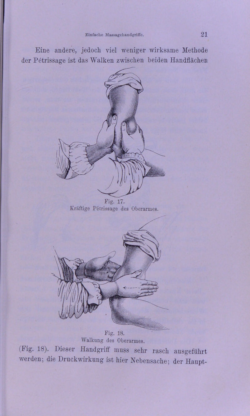 Eine andere, jedoch viel weniger wirksame Methode der Petrissage ist das Walken zwischen beiden Handflächen Fig. 17. Kräftige Petrissage des Oberarmes. Walkung des Oberarmes. (Fig. 18). Dieser Handgriff muss sehr rasch ausgeführt werden; die Druckwirkung ist hier Nebensache; der Haupt-