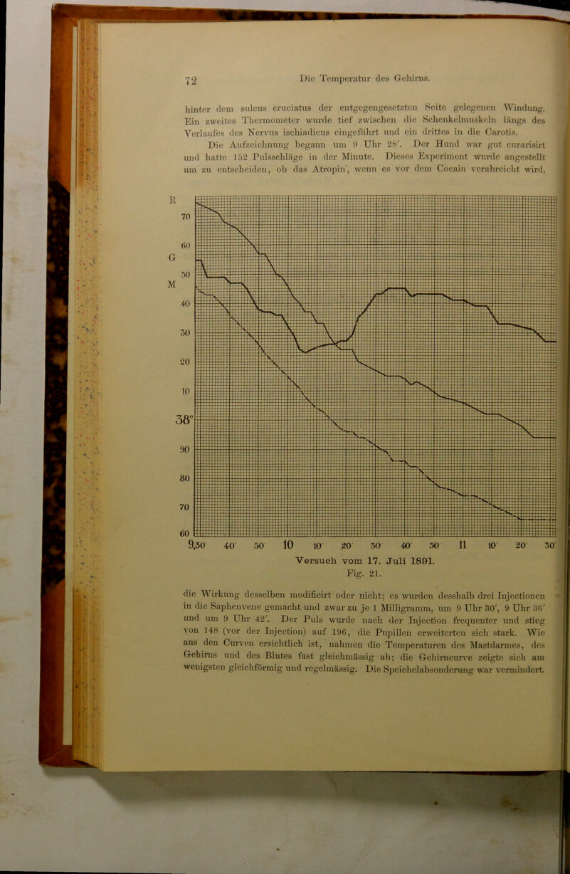 liinter dem sulcus criiciatus der entgegengesetzten Seite gelegenen Windung. Ein zweites Thermometer wurde tief zwischen die Schenkelrnuskeln längs des Verlaufes des Nervus ischiadicus cingeführt und ein drittes in die Carotis. Die Aufzeichnung begann um 9 Uhr 28'. Der Hund war gut curarisirt und hatte 152 Pulsschläge in der Minute. Dieses Experiment wurde angestellt um zu entscheiden, ob das Atropin’, wenn es vor dem Cocain verabreicht wird, 9,30 40' 50 10 10' 20 30 40' 50 II 10' 20 30' ■Versuch vom 17. Juli 1891. Fig. 21. die Wirkung desselben modificirt oder nicht; cs wurden desshalb drei Injectionen in die Saidienvene gemacht und zwar zu je 1 Milligi-amm, um 9 Uhr 30', 9 Uhr 3G' und um 9 Uhr 42'. Der Puls wurde nach der Injection frequenter und stieg von 148 (vor der Injection) auf 196, die Pupillen erweiterten sich stark. Wie aus den Curven ersichtlich ist, nahmen die Temperaturen des Mastdarmes, des Gehirns und des Blutes fast gleichmässig ab; die Gehirncurve zeigte sich am wenigsten gleichföi’mig und regelmässig. Die Speiclielabsondcrung war vermindert.