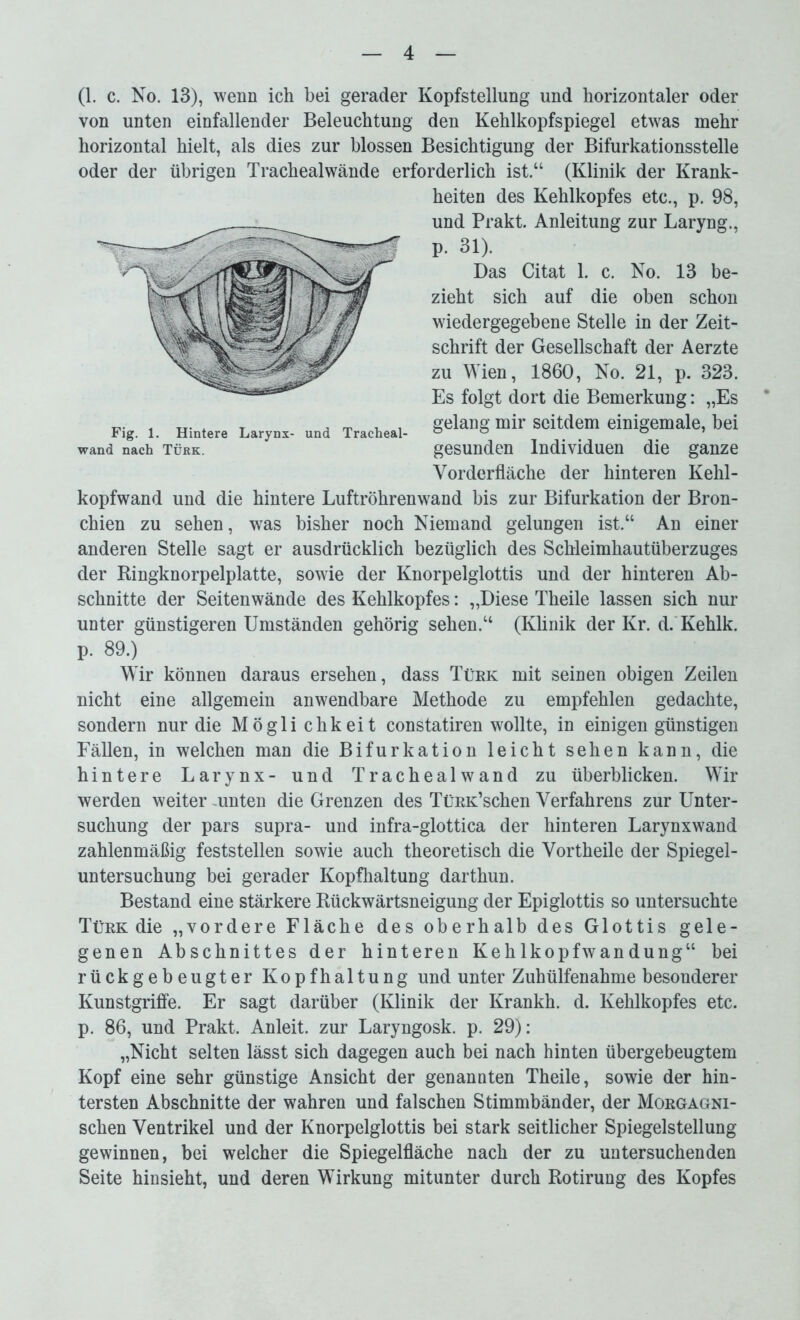 (1. c. No. 13), wenn ich bei gerader Kopfstellung und horizontaler oder von unten einfallender Beleuchtung den Kehlkopfspiegel etwas mehr horizontal hielt, als dies zur blossen Besichtigung der Bifurkationsstelle oder der übrigen Trachealwände erforderlich ist.“ (Klinik der Krank- heiten des Kehlkopfes etc., p. 98, und Prakt. Anleitung zur Laryng., p. 31). Das Citat 1. c. No. 13 be- zieht sich auf die oben schon wiedergegebene Stelle in der Zeit- schrift der Gesellschaft der Aerzte zu Wien, 1860, No. 21, p. 323. Es folgt dort die Bemerkung: „Es gelang mir seitdem einigemale, bei gesunden Individuen die ganze Vorderfläche der hinteren Kehl- kopfwand und die hintere Luftröhren wand bis zur Bifurkation der Bron- chien zu sehen, was bisher noch Niemand gelungen ist.“ An einer anderen Stelle sagt er ausdrücklich bezüglich des Schleimhautüberzuges der Bingknorpelplatte, sowie der Knorpelglottis und der hinteren Ab- schnitte der Seiten wände des Kehlkopfes: „Diese Theile lassen sich nur unter günstigeren Umständen gehörig sehen.“ (Klinik der Kr. d. Kehlk. p. 89.) Wir können daraus ersehen, dass Türk mit seinen obigen Zeilen nicht eine allgemein anwendbare Methode zu empfehlen gedachte, sondern nur die Möglichkeit constatiren wollte, in einigen günstigen Fällen, in welchen man die Bifurkation leicht sehen kann, die hintere Larynx- und Trachealwand zu überblicken. Wir werden weiter .unten die Grenzen des TüRK’schen Verfahrens zur Unter- suchung der pars supra- und infra-glottica der hinteren Larynxwand zahlenmäßig feststellen sowie auch theoretisch die Vortheile der Spiegel- untersuchung bei gerader Kopfhaltung darthun. Bestand eine stärkere Kückwärtsneigung der Epiglottis so untersuchte Türk die „vordere Fläche des oberhalb des Glottis gele- genen Abschnittes der hinteren Kehlkopfwandung“ bei rückgebeugter Kopfhaltung und unter Zuhülfenahme besonderer Kunstgriffe. Er sagt darüber (Klinik der Krankh. d. Kehlkopfes etc. p. 86, und Prakt. Anleit, zur Laryngosk. p. 29): „Nicht selten lässt sich dagegen auch bei nach hinten übergebeugtem Kopf eine sehr günstige Ansicht der genannten Theile, sowie der hin- tersten Abschnitte der wahren und falschen Stimmbänder, der Morgagni- schen Ventrikel und der Knorpelglottis bei stark seitlicher Spiegelstellung gewinnen, bei welcher die Spiegelfläche nach der zu untersuchenden Seite hinsieht, und deren Wirkung mitunter durch Rotirung des Kopfes Fig. 1. Hintere Larynx- und Tracheal- wand nach Türk.