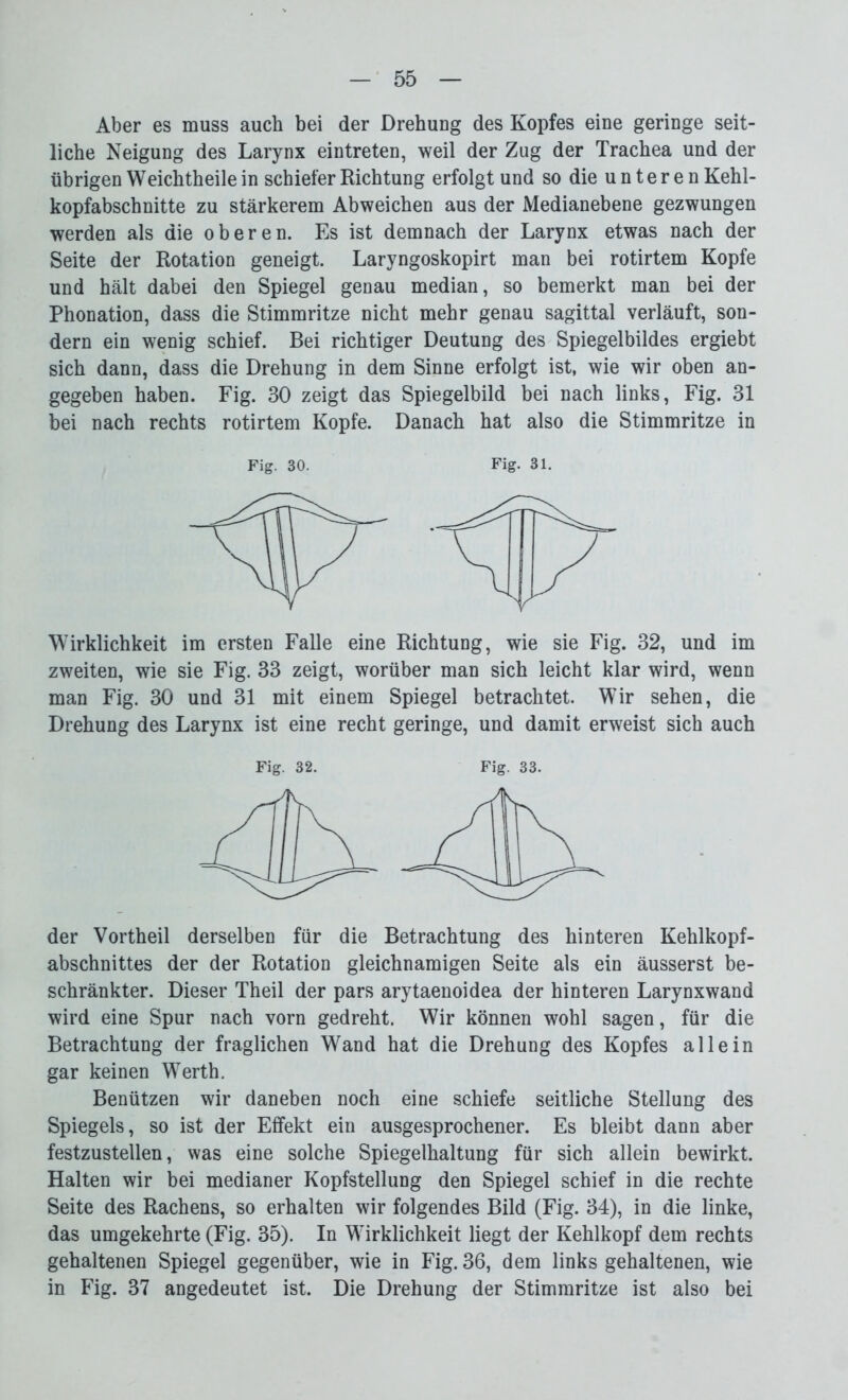 Aber es muss auch bei der Drehung des Kopfes eine geringe seit- liche Neigung des Larynx eintreten, weil der Zug der Trachea und der übrigen Weichtheile in schiefer Richtung erfolgt und so die unteren Kehl- kopfabschnitte zu stärkerem Abweichen aus der Medianebene gezwungen werden als die oberen. Es ist demnach der Larynx etwas nach der Seite der Rotation geneigt. Laryngoskopirt man bei rotirtem Kopfe und hält dabei den Spiegel genau median, so bemerkt man bei der Phonation, dass die Stimmritze nicht mehr genau sagittal verläuft, son- dern ein wenig schief. Bei richtiger Deutung des Spiegelbildes ergiebt sich dann, dass die Drehung in dem Sinne erfolgt ist, wie wir oben an- gegeben haben. Fig. 30 zeigt das Spiegelbild bei nach links, Fig. 31 bei nach rechts rotirtem Kopfe. Danach hat also die Stimmritze in Wirklichkeit im ersten Falle eine Richtung, wie sie Fig. 32, und im zweiten, wie sie Fig. 33 zeigt, worüber man sich leicht klar wird, wenn man Fig. 30 und 31 mit einem Spiegel betrachtet. Wir sehen, die Drehung des Larynx ist eine recht geringe, und damit erweist sich auch der Vortheil derselben für die Betrachtung des hinteren Kehlkopf- abschnittes der der Rotation gleichnamigen Seite als ein äusserst be- schränkter. Dieser Theil der pars arytaenoidea der hinteren Larynxwand wird eine Spur nach vorn gedreht. Wir können wohl sagen, für die Betrachtung der fraglichen Wand hat die Drehung des Kopfes allein gar keinen Werth. Benützen wir daneben noch eine schiefe seitliche Stellung des Spiegels, so ist der Effekt ein ausgesprochener. Es bleibt dann aber festzustellen, was eine solche Spiegelhaltung für sich allein bewirkt. Halten wir bei medianer Kopfstellung den Spiegel schief in die rechte Seite des Rachens, so erhalten wir folgendes Bild (Fig. 34), in die linke, das umgekehrte (Fig. 35). In Wirklichkeit liegt der Kehlkopf dem rechts gehaltenen Spiegel gegenüber, wie in Fig. 36, dem links gehaltenen, wie in Fig. 37 angedeutet ist. Die Drehung der Stimmritze ist also bei Fig. 30. Fig. 31.