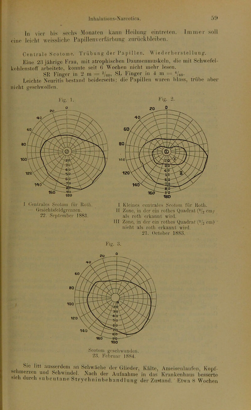 In vier bis sechs Monaten kann Heilung ein!roten. Immer soll eine leicht weissliehe Papillenvcrfnrbnng Zurückbleiben. Centrale Scotome. Trübung der Papillen. Wiederherstellung. Eine 23 jährige Frau, mit atrophischen Daumennmskeln, die mit Schwefel- kohlenstoff arbeitete, konnte seit 6 Wochen nicht mehr lesen. SR Finger in 2 m = 2/00, SJ, Finger in 4 m = 4/r>o- Leichte Neuritis bestand beiderseits; die Papillen waren blass, trübe aber nicht geschwollen. Fig. 1. Fig. -■ Gesichtsfeldgrenzcn. I! Zone, in der ein rothos Quadrat (!/2 cm/ 22. September 1883. als roth erkannt wird. III Zone, in der ein rothes Quadrat (\'2 cm) nicht als roth erkannt wird. 21. Octobcr 18S3. Fig. 3. Scotom geschwunden. 23. Februar 1884. Sie litt ausserdem au Schwäche der Glieder, Kälte, Ameisenlaufen, Kopf- •s( lineizen und Schwindel. Nach der Aufnahme in das Krankenhaus besserte •sich durch subcutane Strychninbehandlung der Zustand. Etwa 8 Wochen
