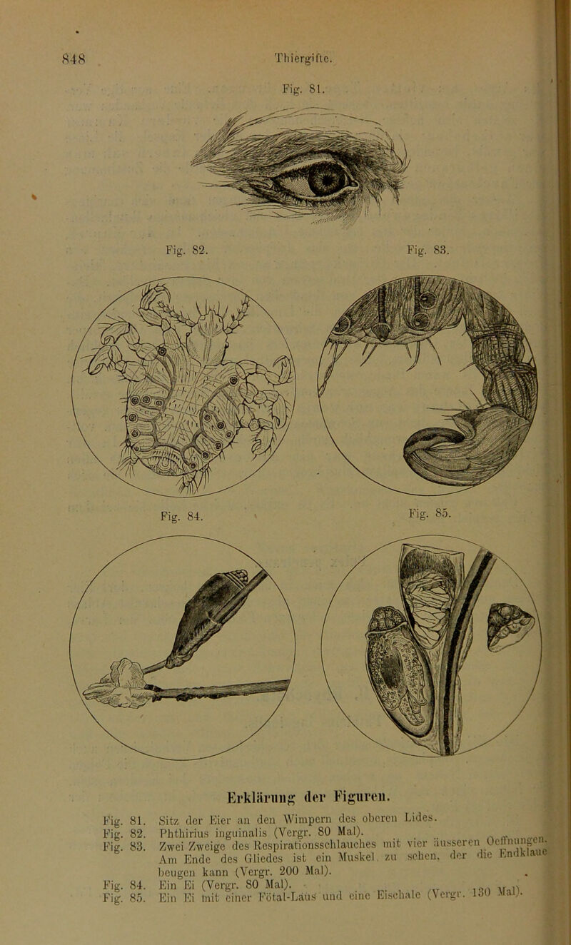 Fig. 81. Fig. 85. Fig. 81. Fig. 82. Fig. 83. Fig. 84. Fig. 85. Erklärung «lei* Figuren. Sitz der Eier an den Wimpern des oberen Lides. Phthirius inguinalis (Vergr. 80 Mal). Zwei Zweige des Respirationsschlauches mit vier ausseren Oeffnungen. Am Ende des Gliedes ist ein Muskel, zu sehen, der die Endklauc beugen kann (Vergr. 200 Mal). Ein Ei (Vergr. SO Mal). n Ein Ei mit einer Fötal-LäüS und eine Eischale (vergr. 13U .nai,. Fig. 82. Fig. 83. Fig. 84.