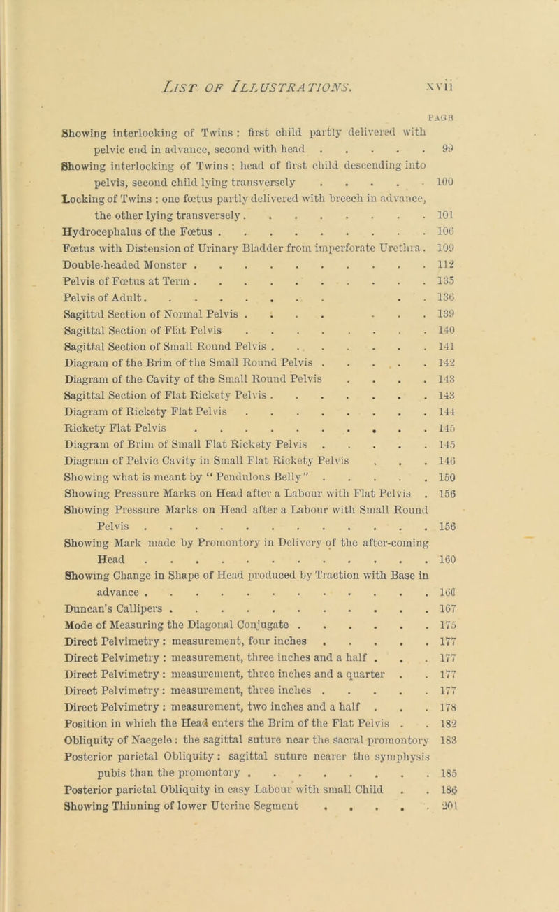 Pag H Showing interlocking of Twins : first child partly delivered with pelvic end in advance, second with head Showing interlocking of Twins: liead of first cliild descending into pelvis, second child lying transversely Locking of Twins ; one fcetus partly delivei’ed with breech in advance, the other lying transversely. Hydrocephalus of the Foetus . Foetus with Distension of Urinary Bladder from iiniierforatc Ui'ethra. Double-headed Monster . Pelvis of Foetus at Term . Pelvis of Adult Sagittal Section of Normal Pelvis . Sagittal Section of Flat Pelvis Sagittal Section of Small Round Pelvis Diagram of the Brim of the Small Round Pelvis . Diagram of the Cavity of the Small Round Pelvis Sagittal Section of Flat Rickety Pelvis . Diagram of Rickety Flat Pelvis .... Rickety Flat Pelvis Diagram of Brim of Small Flat Rickety Pelvis Diagram of Pelvic Cavity in Small Flat Rickety Peh is Showing what is meant by “ Pendulous Belly ” Showing Pressure Marks on Head after a Labour with Flat Pelvis . Showing Pressure Marks on Head after a Labour with Small Round Pelvis Showing Mark made by Promontory in Delivery of the after-coming Head Showing Change in Shape of Head produced by Traction with Base in advance Duncan’s Callipers Mode of Measuring the Diagonal Conjugate Direct Pelvimetry: measurement, four inches Direct Pelvimetry : measurement, three inches and a half . Direct Pelvimetry ; measurement, three inches and a quarter Direct Pelvimetry: measurement, three inches Direct Pelvimetry : measurement, two inches and a half , Position in which the Head enters the Brim of the Flat Pelvis . Obliquity of Naegeio: the sagittal suture near the sacral promontory Posterior parietal Obliquity: sagittal suture nearer the symphysis pubis than the promontory Posterior parietal Obliquity in easy Labour with small Child Showing Thinning of lower Uterine Segment 9:1 100 101 100 109 112 133 130 139 140 141 142 143 143 144 145 145 140 150 156 156 160 100 167 175 177 177 177 177 178 18-2 183 185 186 201