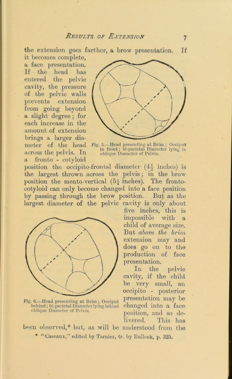 the extension goes farther, a brow presentation. If it becomes complete, a face presentation. If the head has entered the pelvic cavity, the pressure of the pelvic walls prevents extension from going beyond a slight degree; for each increase in the amount of extension brings a larger dia- meter of the head across the pelvis. In a fronto - cotyloid position the occipito-fron tal diameter (41 inches) is the largest thrown across the pelvis; in the brow position the mento-vertical (5^ inches). The fronto- cotyloid can only become changed into a face position by passing through the brow position. But as the cavity is only about five inches, this is impossible with a child of average size. But above the brim extension may and does go on to the production of face presentation. In the pelvic cavity, if the child be very small, an occipito - posterior presentation may be changed into a face position, and so de- livered. Tliis has understood from the * “Caseaux,” edited by Tarnier, tr. by Bullock, p. 325, largest diameter of the pelvic been observed,* but, as will be