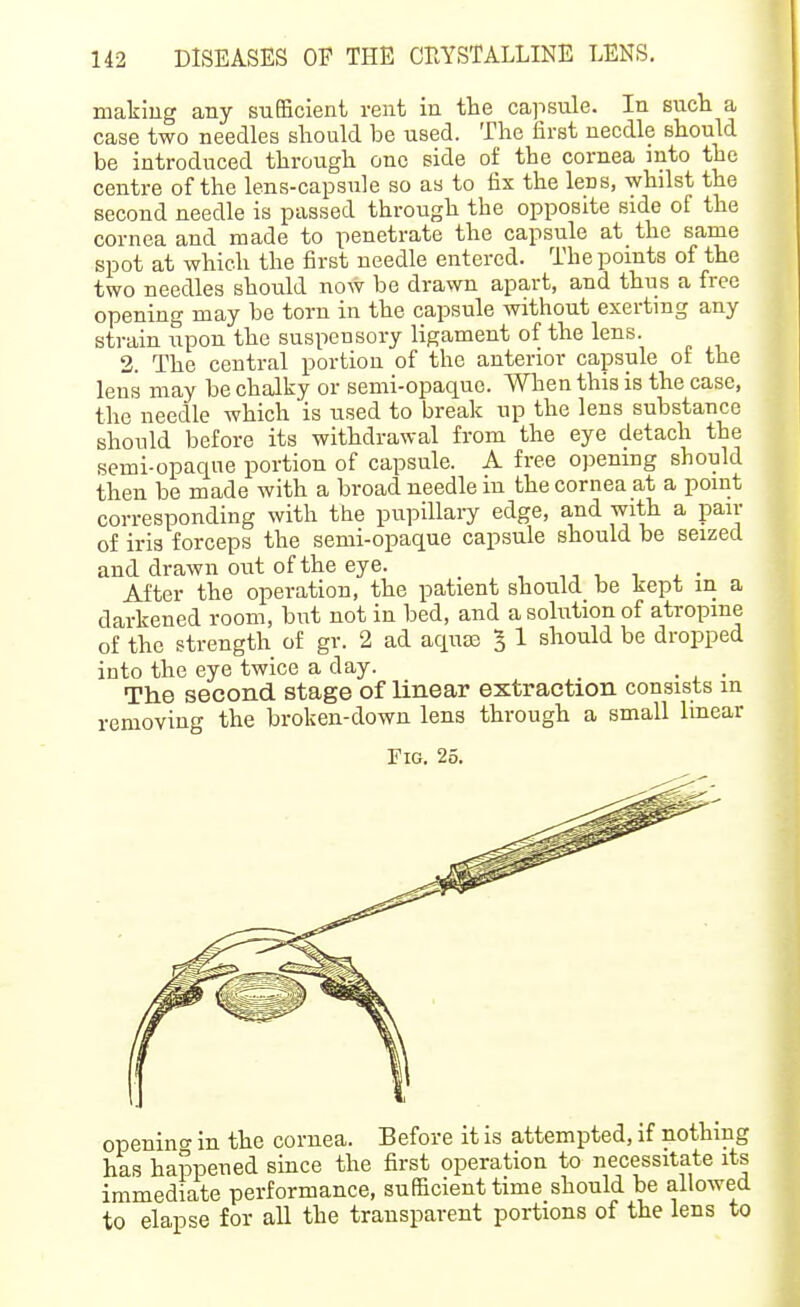 making any sufficient rent in the capsule. In sucli a case two needles should be used. The first needle should be introduced through one side of the cornea into the centre of the lens-capsule so as to fix the lens, whilst the second needle is passed through the opposite side of the cornea and made to penetrate the capsule at the same spot at which the first needle entered. The points of the two needles should now be drawn apart, and thus a free opening may be torn in the capsule without exerting any strain upon the suspensory ligament of the lens. 2. The central portion of the anterior capsule of the lens may be chalky or semi-opaque. When this is the case, the needle which is used to break up the lens substance should before its withdrawal from the eye detach the semi-opaque portion of capsule. A free opening should then be made with a broad needle in the cornea at a point corresponding with the pupillary edge, and with a pair of iris forceps the semi-opaque capsule should be seized and drawn out of the eye. ■,^ ^ , ■ After the operation, the patient should be kept in a darkened room, but not in bed, and a solution of atropine of the strength of gr. 2 ad aquas 5 1 should be dropped into the eye twice a day. . The second stage of linear extraction consists m removing the broken-down lens through a small Imear Fig. 25. opening in the cornea. Before it is attempted, if nothing has happened since the first operation to necessitate its immediate performance, sufficient time should be allowed to elapse for all the transparent portions of the lens to