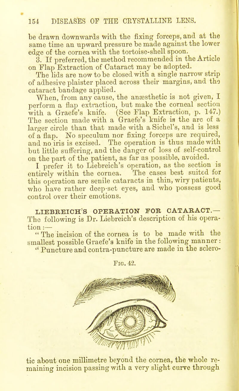 be drawn downwards with the fixing forceps, and at the same time an upward pressure be made against the lower edge of the cornea with the tortoise-shell spoon. 3. If preferred, the method recommended in the Article on Flap Extraction of Cataract may be adopted. The lids are now to be closed with a single narrow strip of adhesive plaister placed across their margins, and tho cataract bandage applied. When, from any cause, the anassthetic is not given, I perform a flap extraction, but make the corneal section with a Graefe's knife. (See Flap Extraction, p. 147.) The section made with a Graefe's knife ia the arc of a larger circle than that made with a Sichel's, and is less of a flap. No speculum nor fixing forceps are required, and no iris is excised. The operation is thus made with but little suffering, and the danger of loss of self-control on the part of the patient, as far as possible, avoided. I prefer it to Liebreich's operation, as the section is entirely within the cornea. The cases best suited for this operation are senile cataracts in thin, wiry patients, who have rather deep-set eyes, and who possess good control over their emotions. LIEBREICH'S OPERATION FOR CATARACT.— The following is Dr. Liebreich's description of his opera- tion :—  The incision of the cornea is to be made with the smallest possible Graefe's knife in the following manner :  Puncture and contra-puncture are made in the sclero- FiG. 42. tic about one millimetre beyond the cornea, the whole re- maining incision passing with a very slight curve through