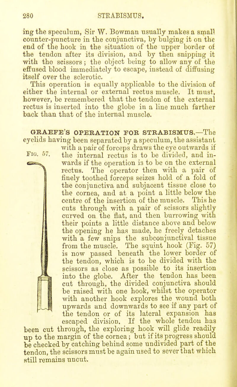 ing the speculum, Sir W. Bowman usually makes a small counter-puncture in the conjunctiva, by bulging it on the end of the hook in the situation of the upper border of the tendon after its division, and by then snipping it with tho scissors ; the object being to allow any of the efEused blood immediately to escape, instead of diffusing itself over the sclerotic. This operation is equally applicable to the division of either the internal or external rectus muscle. It must, however, be remembered that the tendon of the external rectus is inserted into the globe in a line much farther back than that of the internal muscle. GKAEPE'S OPERATION FOR STRABISMTJS.—The eyelids having been separated by a speculum, the assistant with a pair of forceps draws the eye outwards if Fig. 57. the internal rectus is to be divided, and in- wards if the operation is to be on the external rectus. The operator then with a pair of finely toothed forceps seizes hold of a fold of the conjunctiva and subjacent tissue close to the cornea, and at a point a little below the centre of the insertion of the muscle. This he cuts through with a pair of scissors slightly curved on the flat, and then burrowing with their points a little distance above and below the opening he has made, he freely detaches with a few snips the subconjunctival tissue from the muscle. The squint hook (Fig. 57) is now passed beneath the lower border of the tendon, which is to be divided with the scissors as close as possible to its insertion into the globe. After the tendon has been cut through, the divided conjunctiva should be raised with one hook, whilst the operator with another hook explores the wound both upwards and downwards to see if any part of the tendon or of its lateral expansion has escaped division. If the whole tendon has been cut through, the exploring hook will glide readily up to the margin of the cornea; but if its pi-ogress should be checked by catching behind some undivided part of the tendon, the scissors must be again used to sever that which still remains uncut.