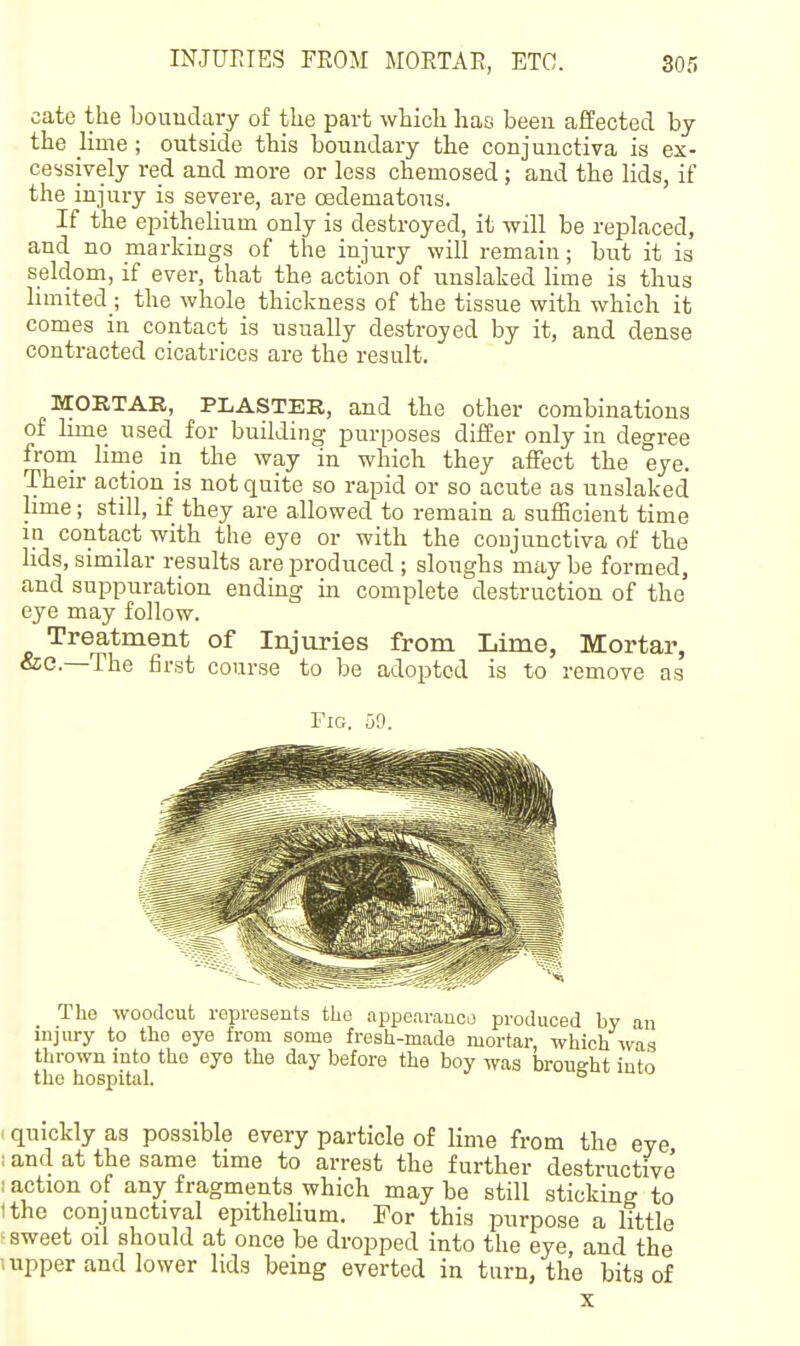 INJUrJES FKOM MOETAR, ETC. cate the boundary of the part which has been affected by the lime; outside this boundary the conjunctiva is ex- cessively red and more or less chemosed ; and the lids, if the injury is severe, are cedematous. If the epithelium only is destroyed, it will be replaced, and no markings of the injury will remain; but it is seldom, if ever, that the action of unslaked lime is thus hmited j the whole thickness of the tissue with which it comes in contact is usually destroyed by it, and dense contracted cicatrices are the result. MORTAR, PLASTER, and the other combinations of lime used for building purposes differ only in degree frona lime in the way in which they affect the eye. Their action is not quite so rapid or so acute as unslaked lime; still, if they are allowed to remain a sufficient time in conta,ct with the eye or with the conjunctiva of the hds, similar results are produced ; sloughs may be formed, and suppuration ending in complete destruction of the eye may follow. Treatment of Injuries from Lime, Mortar, &c.—The first course to be adopted is to remove as Fir;. fjD. The woodcut represents the appearauco produced by an injury to the eye from some fresh-made mortar, which was thrown into the eye the day before the boy was brought into the hospital. ° ' quickly as possible every particle of lime from the eye ; and at the same time to arrest the further destructive 1 action of any fragments which may be still sticking to ithe conjunctival epithelium. For this purpose a little • sweet oil should at once be dropped into the eye, and the iupper and lower lids being everted in turn, the bits of X