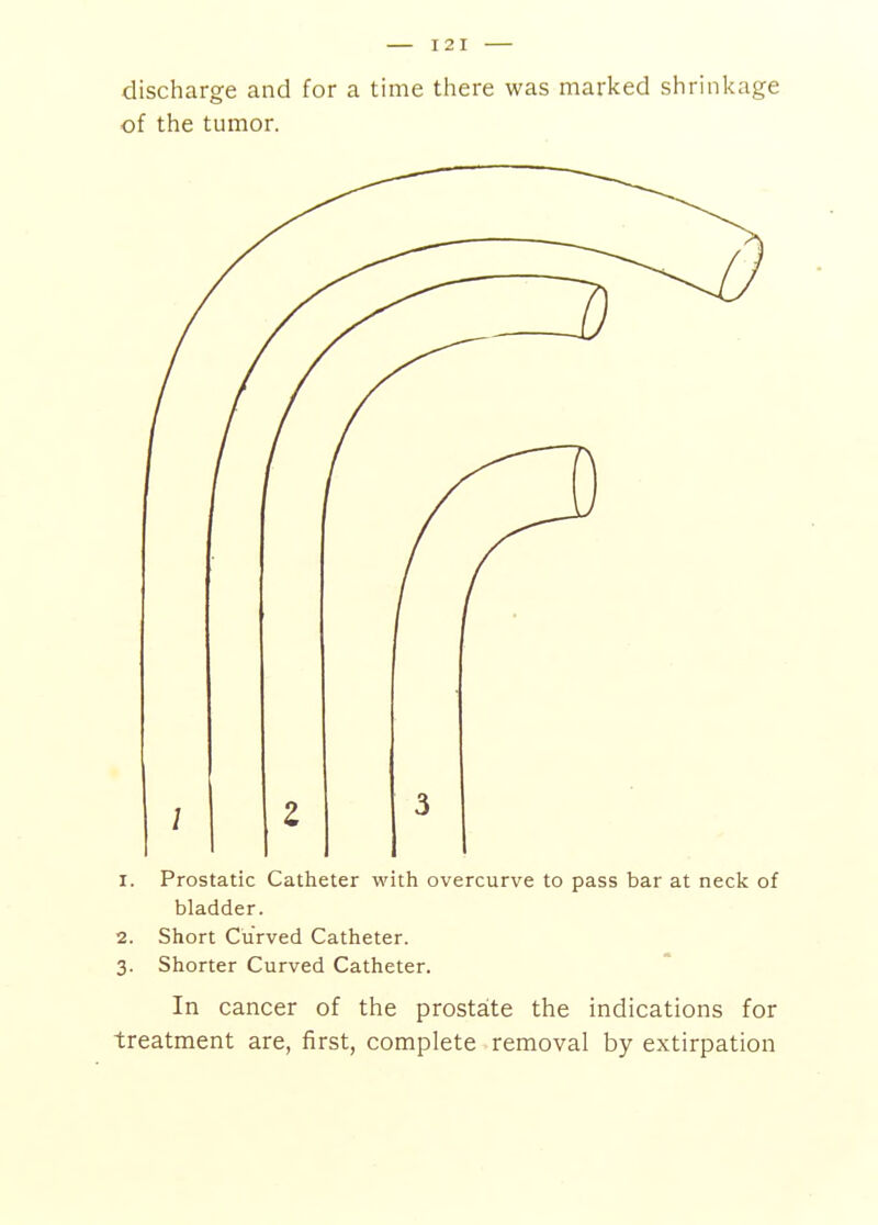 discharge and for a time there was marked shrinkage of the tumor. 1. Prostatic Catheter with overcurve to pass bar at neck of bladder. 2. Short Curved Catheter. 3. Shorter Curved Catheter. In cancer of the prostaite the indications for treatment are, first, complete removal by extirpation