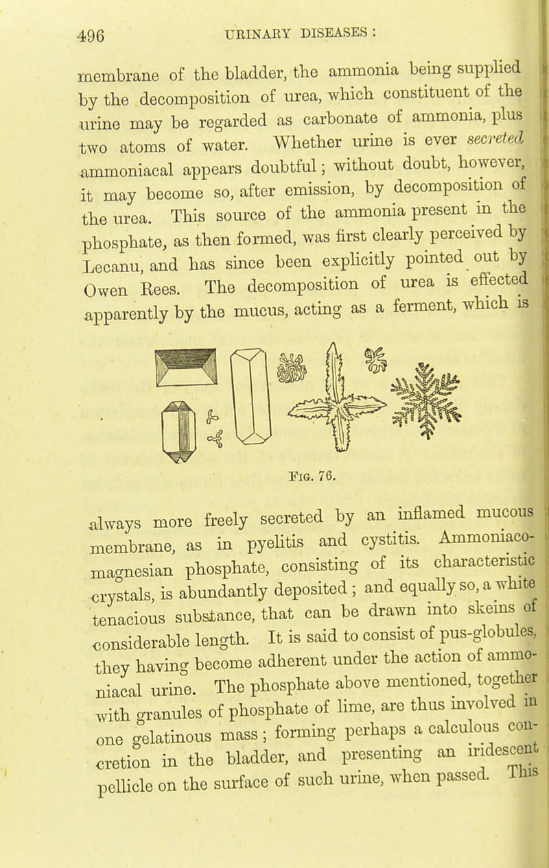 membrane of the bladder, the ammonia being supplied by the decomposition of urea, which constituent of the urine may be regarded as carbonate of ammonia, plus two atoms of water. Whether urine is ever secreted ammoniacal appears doubtful; without doubt, however, it may become so, after emission, by decomposition of the urea. This source of the ammonia present in the phosphate, as then formed, was first clearly perceived by Lecanu,and has since been explicitly pointed out by Owen Kees. The decomposition of urea is effected apparently by the mucus, acting as a ferment, which is Fig. 76. always more freely secreted by an inflamed mucous membrane, as in pyehtis and cystitis. Ammomaco- ma-nesian phosphate, consisting of its characteristic ^ crystals, is abundantly deposited; and equaUy so, a white tenacious substance, that can be drawn into skeins ot j considerable length. It is said to consist of pus-globules, they having become adherent under the action of ammo- ^ niacal urine. The phosphate above mentioned, together | with granules of phosphate of lime, are thus involved m one gelatinous mass; forming perhaps a calculous con- cretion in the bladder, and presenting an iridescent pelHcle on the surface of such urine, when passed, ims