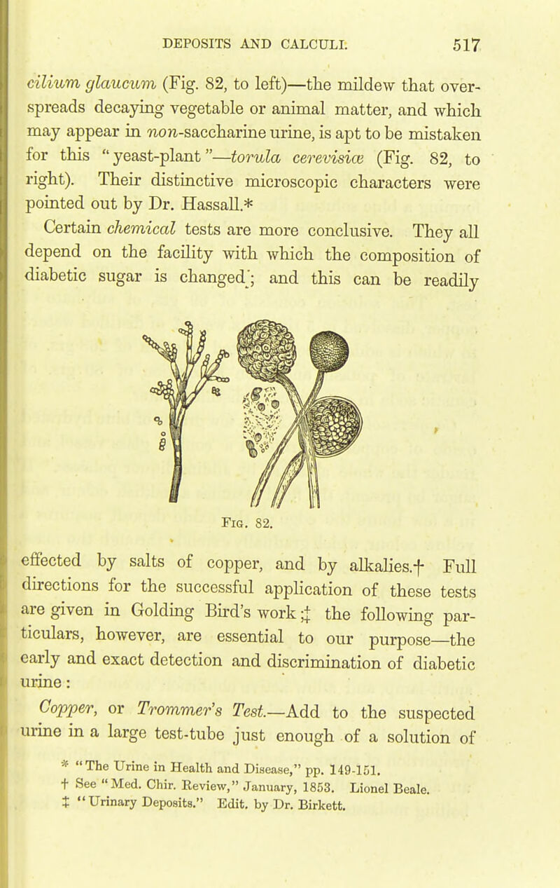 cilium glaucum (Fig. 82, to left)—tlie mildew that over- spreads decaying vegetable or animal matter, and which may appear in 'non-saccharine urine, is apt to be mistaken for this yeast-plant—torula cerevisice (Fig. 82, to right). Their distinctive microscopic characters were pointed out by Dr. Hassall.* Certain chemical tests are more conclusive. They all depend on the facihty with which the composition of diabetic sugar is changed'; and this can be readily Fig. 82. effected by salts of copper, and by alkalies.f Full directions for the successful application of these tests are given in Golding End's work;+ the foUowing par- ticulars, however, are essential to our purpose—the early and exact detection and discrimdnation of diabetic urine: Copper, or Trommer's Test—Add to the suspected urine in a large test-tube just enough of a solution of * The Urine in Health and Disease, pp. 149-151. t See Med. Chir. Eeview, January, 1853. Lionel Beale. t  Urinary Deposits. Edit, by Dr. Birkett.