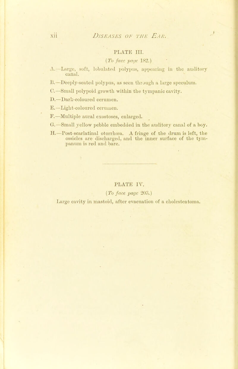 PLATE III. (To face payc 182.) A. —Largo, suft, tabulated polypus, appearing in tlic auditory canal. B. —Deeply-seated polypus, as seen through a large speculum. C. —Small polypoid growth within the tympanic cavity. D. —Dark-coloured cerumen. E. —Light-coloured cerumen. F. —Multiple aural exostoses, enlarged. G. —Small yellow pebble embedded in the auditory canal of a boy. H. —Post-scarlatinal otorrhcea. A fringe of the drum is left, the ossicles are discharged, and the inner surface of the tym- panum is red and bare. PLATE IV. (To face page 203.) Large cavity in mastoid, after evacuation of a cholesteatoma.