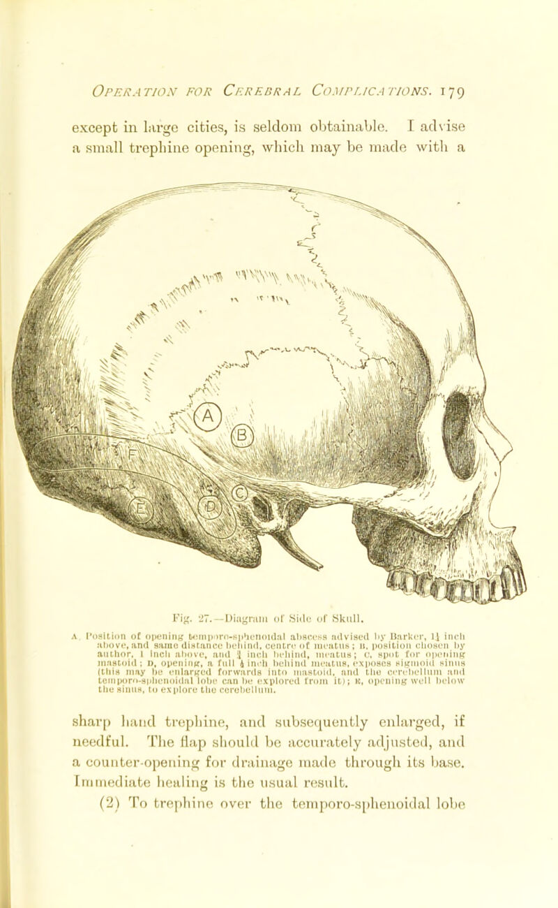 except in large cities, is seldom obtainable. I advise a small trephine opening, which may be made with a Fig. 2. Diagram of Side of Skull. a Position of opening feemporo-sptienoidal abscess advised by Barker, U Inch above,and Bamedistance behind, centre of meatus; u, position chosen by author, l inch abovet and :| inch behind! meatus; o, spot for opening mastoid; n, opening, a full (inch behind meatus, exposes sigmoid Binus (this may be enlarged forwards into mastoid, ami the cerebellum and tcinporo-sphenniihil lobe can be explored from it); k, opening well below tlie sinus, in ex piore the cerebellum. sharp hand trephine, and subsequently enlarged, if needful. The Hap should be accurately adjusted, and a counter-opening for drainage made through its hase. [rumediate healing is the usual result. (2) To trephine over the temporo-sphenoidal lobe