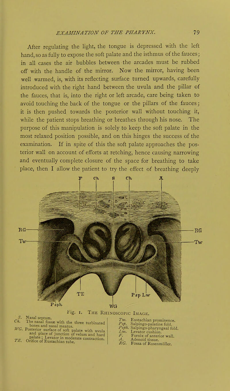 After regulating the light, the tongue is depressed with the left hand, so as fully to expose the soft palate and the isthmus of the fauces; in all cases the air bubbles between the arcades must be rubbed off with the handle of the mirror. Now the mirror, having been well warmed, is, with its reflecting surface turned upwards, carefully introduced with the right hand between the uvula and the pillar of the fauces, that is, into the right or left arcade, care being taken to avoid touching the back of the tongue or the pillars of the fauces; it is then pushed towards the posterior wall without touching it, while the patient stops breathing or breathes through his nose. The purpose of this manipulation is solely to keep the soft palate in the most relaxed position possible, and on this hinges the success of the examination. If in spite of this the soft palate approaches the pos- terior wall on account of efforts at retching, hence causing narrowing and eventually complete closure of the space for breathing to take place, then I allow the patient to try the effect of breathing deeply HG Ck. Nasal septum. The nasal fossse with the three turbinated bones and nasal meatus. WG. Posterior surface of soft palate with uvula and place of junction of velum and hard ■rn -.^-c \ Levator in moderate contraction. J^. Orifice of Eustachian tube. The Rhinoscopic Image. Tw. Eustachian prominence. Psp. .Salpingo-palatine fold. Psph. Salpingo-pharyngeal fold. Lw. Levator cushion. F. Fornix of anterior wall. A. Adenoid tissue. RG, Fossa of Rosenmiiller.