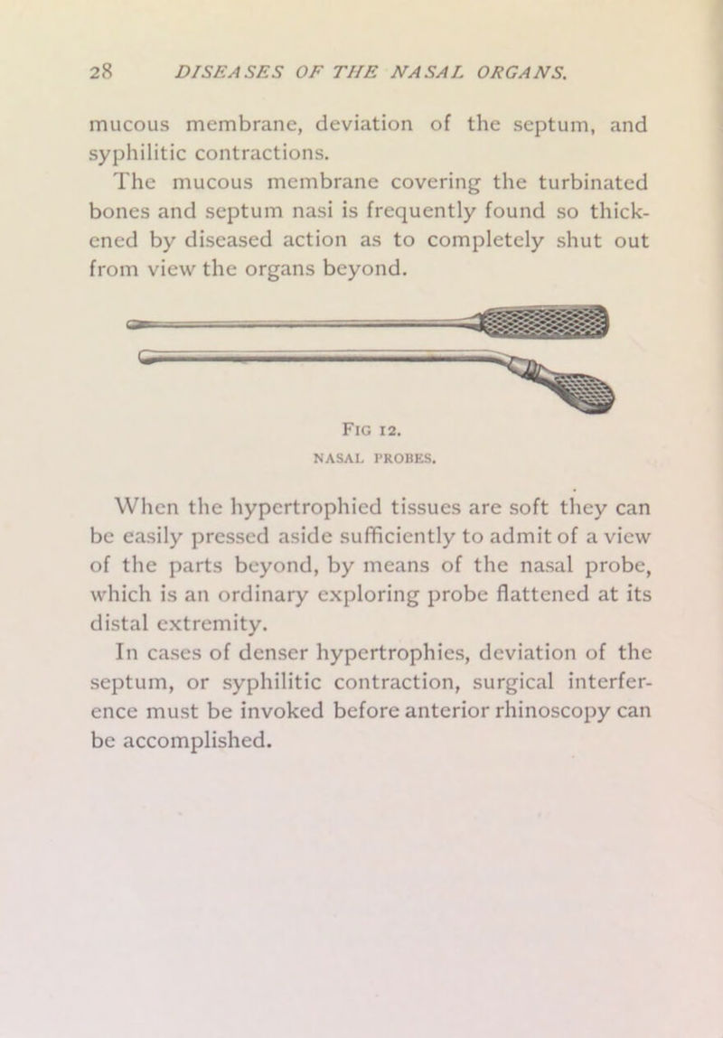 mucous membrane, deviation of the septum, and syphilitic contractions. The mucous membrane covering the turbinated bones and septum nasi is frequently found so thick- ened by diseased action as to completely shut out from view the organs beyond. Fig 12. NASAL PROBES. When the hypertrophied tissues are soft they can be easily pressed aside sufficiently to admit of a view of the parts beyond, by means of the nasal probe, which is an ordinary exploring probe flattened at its distal extremity. In cases of denser hypertrophies, deviation of the septum, or syphilitic contraction, surgical interfer- ence must be invoked before anterior rhinoscopy can be accomplished.