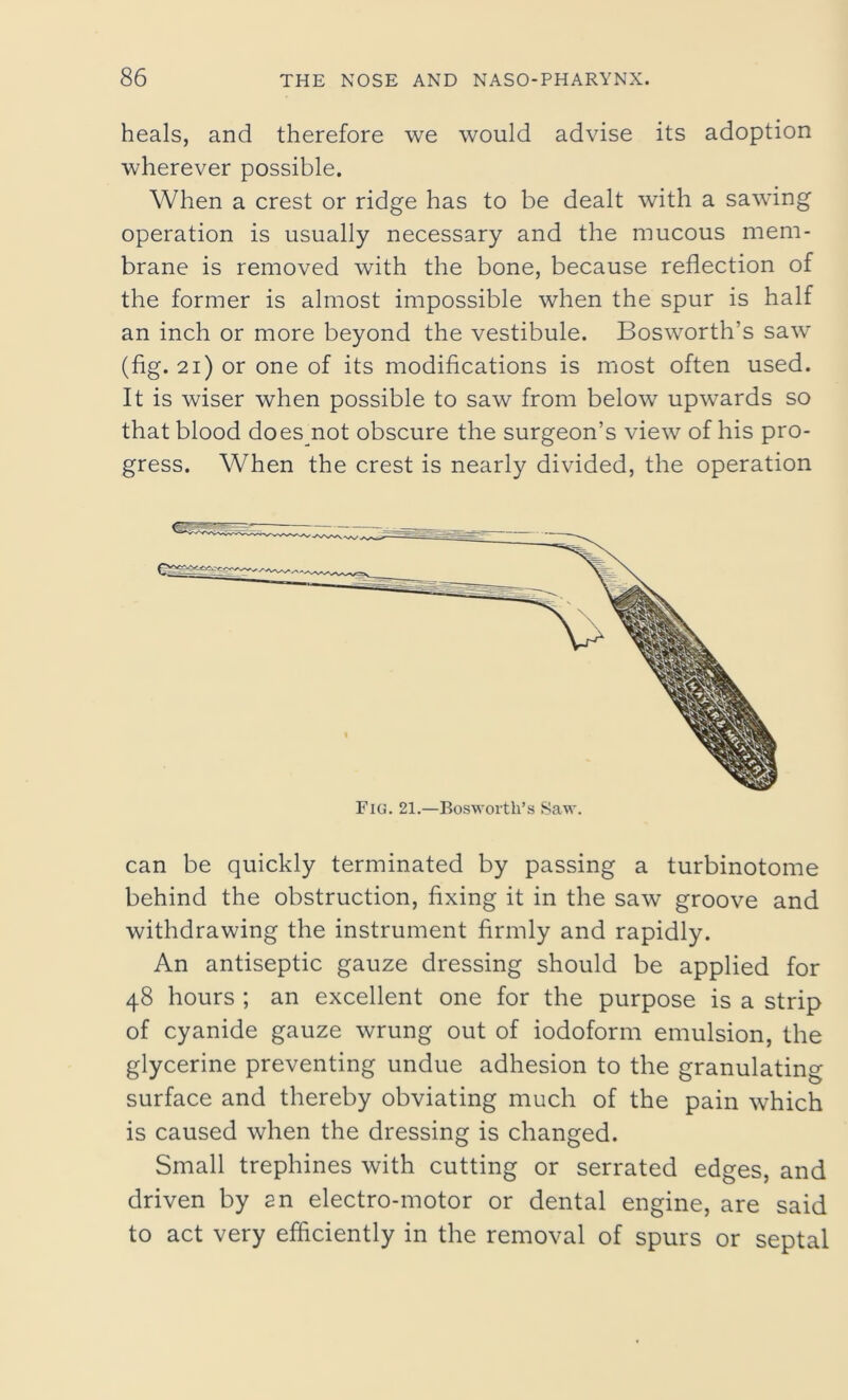 heals, and therefore we would advise its adoption wherever possible. When a crest or ridge has to be dealt with a sawing operation is usually necessary and the mucous mem- brane is removed with the bone, because reflection of the former is almost impossible when the spur is half an inch or more beyond the vestibule. Bosworth’s saw (fig. 21) or one of its modifications is most often used. It is wiser when possible to saw from below upwards so that blood does not obscure the surgeon’s view of his pro- gress. When the crest is nearly divided, the operation Fig. 21.—Bosworth’s Saw. can be quickly terminated by passing a turbinotome behind the obstruction, fixing it in the saw groove and withdrawing the instrument firmly and rapidly. An antiseptic gauze dressing should be applied for 48 hours ; an excellent one for the purpose is a strip of cyanide gauze wrung out of iodoform emulsion, the glycerine preventing undue adhesion to the granulating surface and thereby obviating much of the pain which is caused when the dressing is changed. Small trephines with cutting or serrated edges, and driven by an electro-motor or dental engine, are said to act very efficiently in the removal of spurs or septal