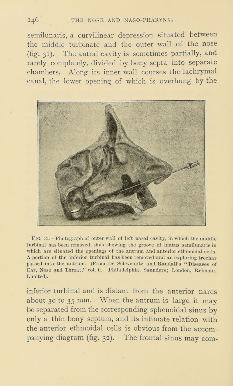 semilunaris, a curvilinear depression situated between the middle turbinate and the outer wall of the nose (fig. 31). The antral cavity is sometimes partially, and rarely completely, divided by bony septa into separate chambers. Along its inner wall courses the lachrymal canal, the lower opening of which is overhung by the Fig. 31.—Photograph of outer wall of left nasal cavity, in which the middle turbinal has been removed, thus showing the groove of hiatus semilunaris in which are situated the openings of the antrum and anterior ethmoidal cells. A portion of the inferior turbinal has been removed and an exploring trochar passed into the antrum. (From De Schweinitz and Randall’s “Diseases of Ear, Nose and Throat,” vol. ii. Philadelphia, Saunders; London, Rebman, Limited). inferior turbinal and is distant from the anterior nares about 30 to 35 mm. When the antrum is large it may be separated from the corresponding sphenoidal sinus by only a thin bony septum, and its intimate relation with the anterior ethmoidal cells is obvious from the accom- panying diagram (fig. 32). The frontal sinus may com-