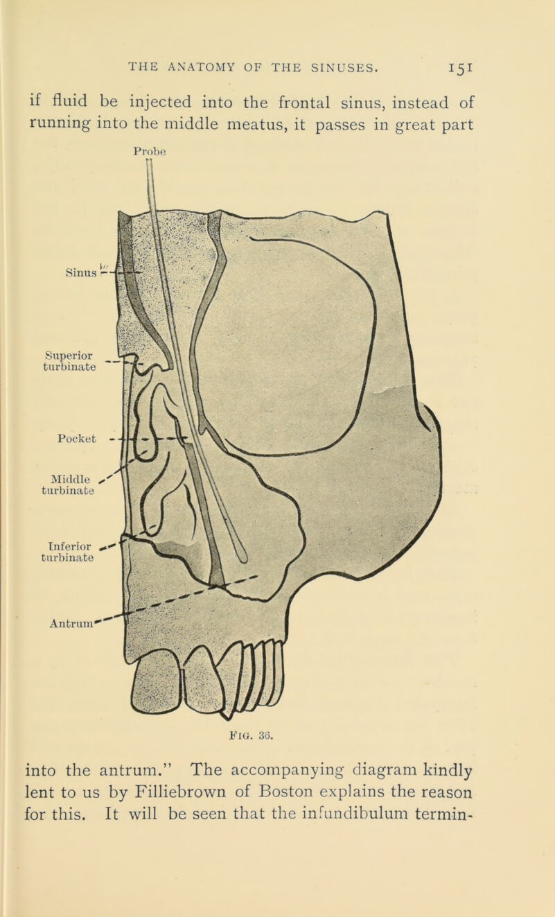 if fluid be injected into the frontal sinus, instead of running into the middle meatus, it passes in great part Probe into the antrum.” The accompanying diagram kindly lent to us by Filliebrown of Boston explains the reason for this. It will be seen that the infundibulum termin-