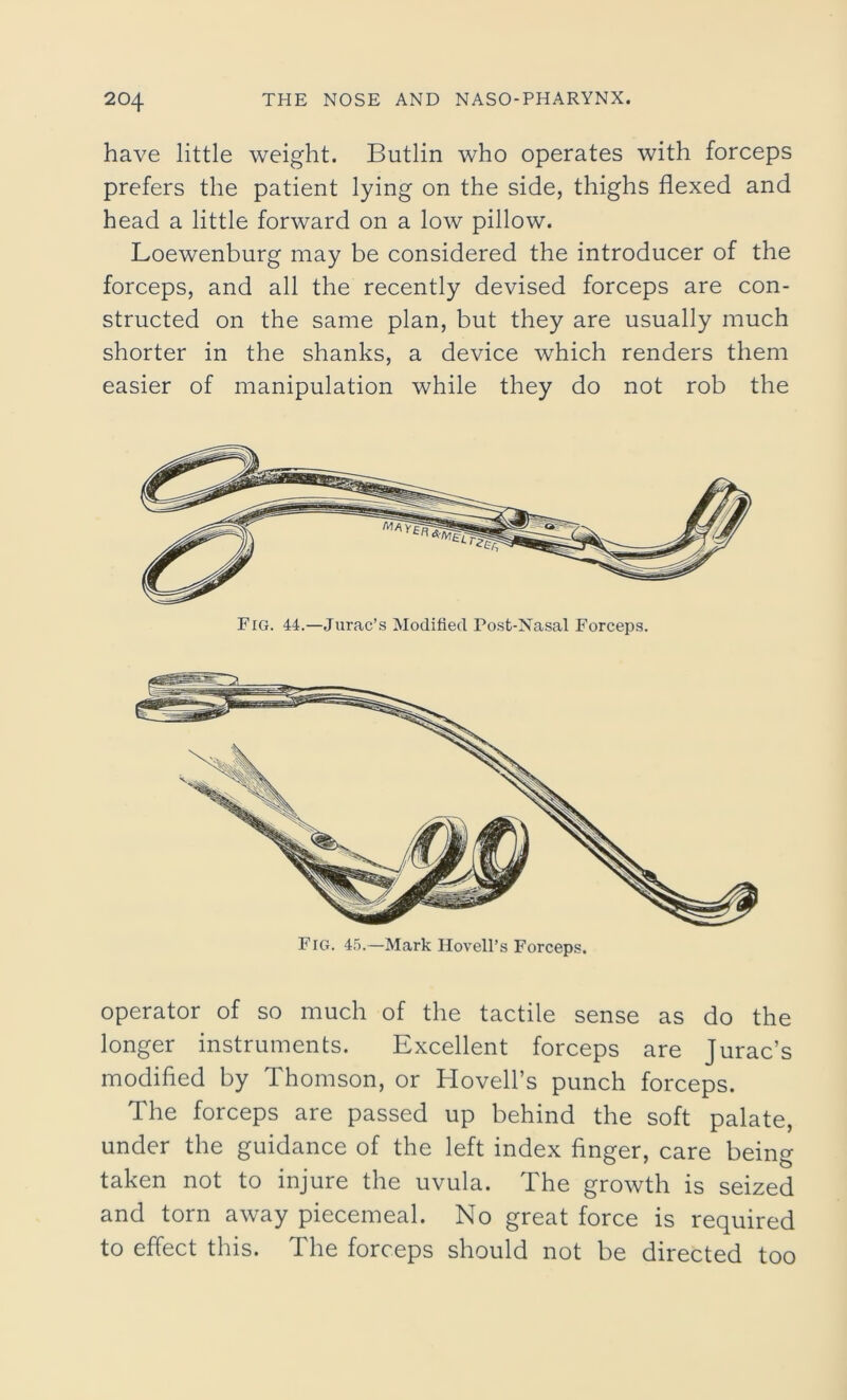 have little weight. Butlin who operates with forceps prefers the patient lying on the side, thighs flexed and head a little forward on a low pillow. Loewenburg may be considered the introducer of the forceps, and all the recently devised forceps are con- structed on the same plan, but they are usually much shorter in the shanks, a device which renders them easier of manipulation while they do not rob the Fig. 45.—Mark Hovell’s Forceps. operator of so much of the tactile sense as do the longer instruments. Excellent forceps are Jurac’s modified by Thomson, or Hovell’s punch forceps. The forceps are passed up behind the soft palate, under the guidance of the left index finger, care being taken not to injure the uvula. The growth is seized and torn away piecemeal. No great force is required to effect this. The forceps should not be directed too