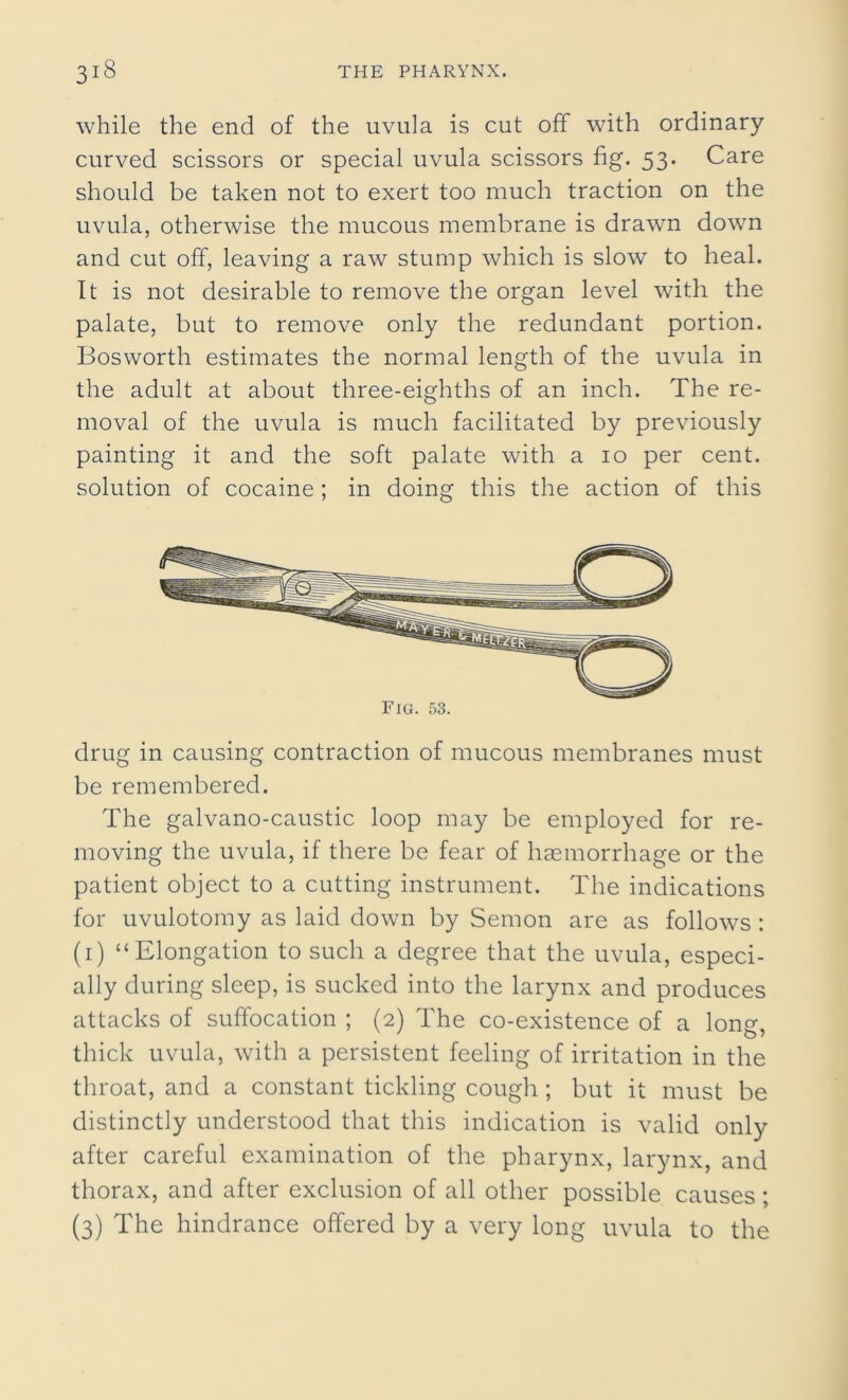 while the end of the uvula is cut off with ordinary curved scissors or special uvula scissors fig. 53. Care should be taken not to exert too much traction on the uvula, otherwise the mucous membrane is drawn down and cut off, leaving a raw stump which is slow to heal. It is not desirable to remove the organ level with the palate, but to remove only the redundant portion. Bosworth estimates the normal length of the uvula in the adult at about three-eighths of an inch. The re- moval of the uvula is much facilitated by previously painting it and the soft palate with a 10 per cent, solution of cocaine; in doing this the action of this Fig. 53. drug in causing contraction of mucous membranes must be remembered. The galvano-caustic loop may be employed for re- moving the uvula, if there be fear of haemorrhage or the patient object to a cutting instrument. The indications for uvulotomy as laid down by Semon are as follows: (1) “ Elongation to such a degree that the uvula, especi- ally during sleep, is sucked into the larynx and produces attacks of suffocation ; (2) The co-existence of a Ion a1 thick uvula, with a persistent feeling of irritation in the throat, and a constant tickling cough; but it must be distinctly understood that this indication is valid only after careful examination of the pharynx, larynx, and thorax, and after exclusion of all other possible causes ; (3) The hindrance offered by a very long uvula to the