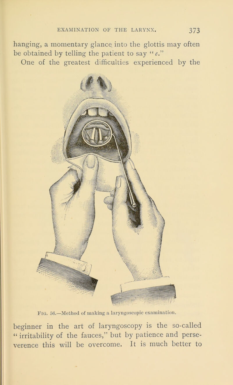 hanging, a momentary glance into the glottis may often be obtained by telling the patient to say lt e.” One of the greatest difficulties experienced by the Fig. 56.—Method of making a laryngoscopic examination. beginner in the art of laryngoscopy is the so-called “ irritability of the fauces,” but by patience and perse- verence this will be overcome. It is much better to