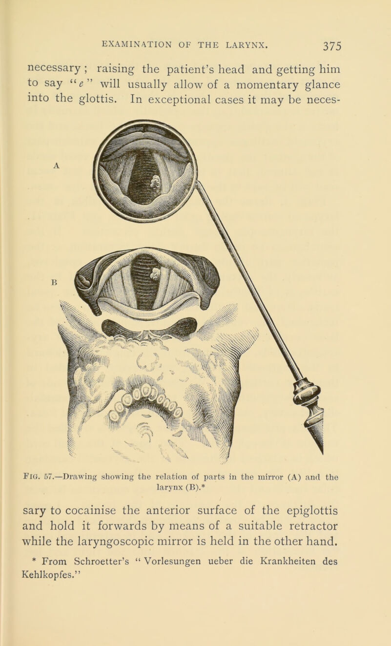 necessary ; raising the patient’s head and getting him to say ue will usually allow of a momentary glance into the glottis. In exceptional cases it may be neces- Fig. 57.—Drawing showing the relation of parts in the mirror (A) and the larynx (B).* sary to cocainise the anterior surface of the epiglottis and hold it forwards by means of a suitable retractor while the laryngoscopic mirror is held in the other hand. * From Schroetter’s “ Vorlesungen ueber die Krankheiten des Kehlkopfes.”