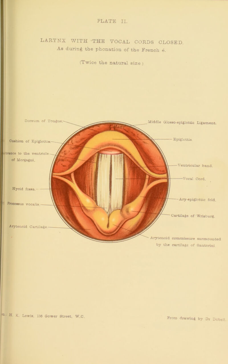 ===== | PLATE II. LARYNX WITH THE VOCAL CORDS CLOSED. As during the phonation of the French e (Twice the natural size ) Dorsutn of Tongue Epiglottis Ventricular band. Vocal Cord. Ary-epiglottic fold. Cartilage of Wrisburg. Arytenoid commissure surmounted Cushion of Epiglottis trance to the ventricle of Morgagni. Hyoid fossa.- Processus vocalis Middle Glosso-epiglottic Ligament. Arytenoid Cartilage by the cartilage of Santorini [Q* H. K. Lewis, 136 Gower Street, W.C.