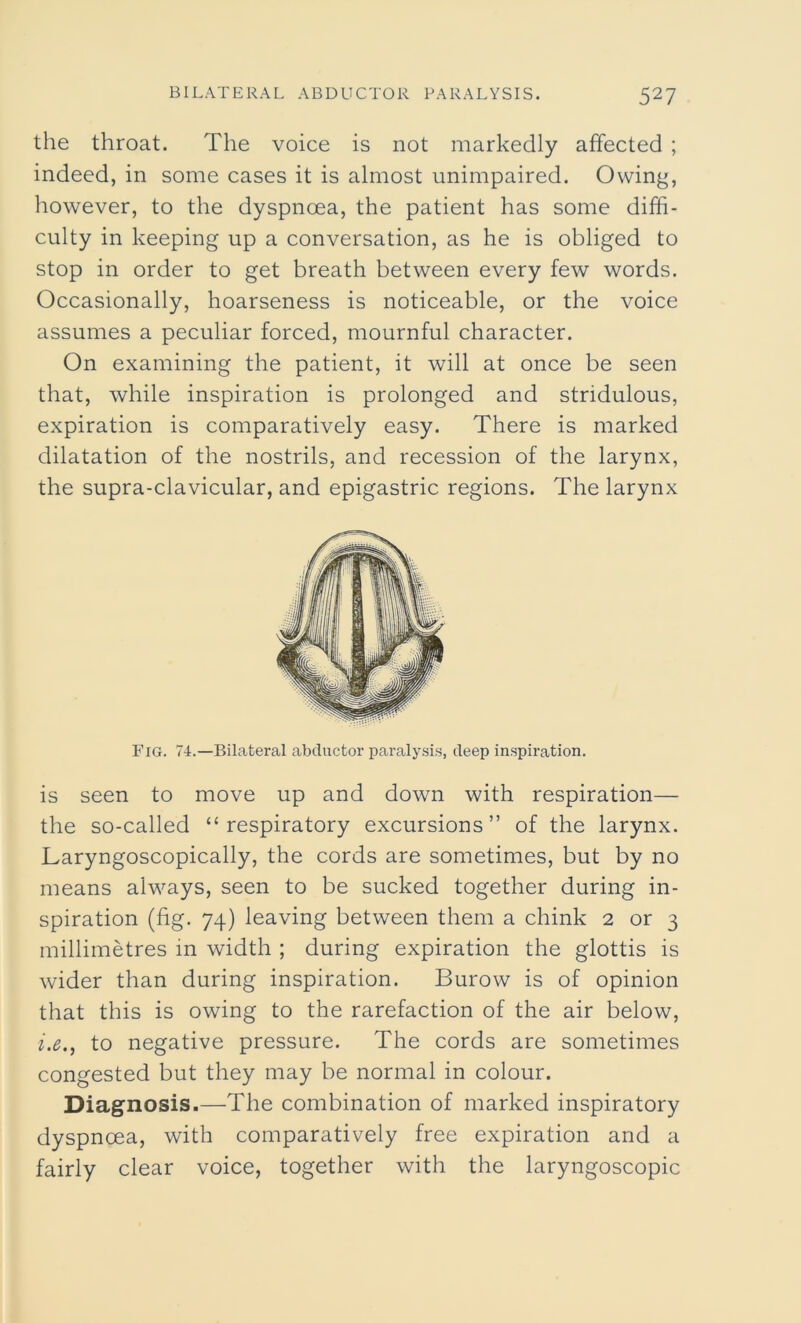 the throat. The voice is not markedly affected ; indeed, in some cases it is almost unimpaired. Owing, however, to the dyspnoea, the patient has some diffi- culty in keeping up a conversation, as he is obliged to stop in order to get breath between every few words. Occasionally, hoarseness is noticeable, or the voice assumes a peculiar forced, mournful character. On examining the patient, it will at once be seen that, while inspiration is prolonged and stridulous, expiration is comparatively easy. There is marked dilatation of the nostrils, and recession of the larynx, the supra-clavicular, and epigastric regions. The larynx Fig. 74.—Bilateral abductor paralysis, deep inspiration. is seen to move up and down with respiration— the so-called “respiratory excursions” of the larynx. Laryngoscopically, the cords are sometimes, but by no means always, seen to be sucked together during in- spiration (fig. 74) leaving between them a chink 2 or 3 millimetres in width ; during expiration the glottis is wider than during inspiration. Burow is of opinion that this is owing to the rarefaction of the air below, i.e., to negative pressure. The cords are sometimes congested but they may be normal in colour. Diagnosis.—The combination of marked inspiratory dyspnoea, with comparatively free expiration and a fairly clear voice, together with the laryngoscopic