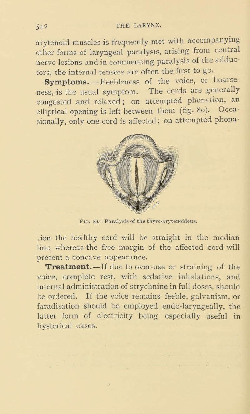 arytenoid muscles is frequently met with accompanying other forms of laryngeal paralysis, arising from central nerve lesions and in commencing paralysis of the adduc- tors, the internal tensors are often the first to go. Symptoms. — Feebleness of the voice, or hoarse- ness, is the usual symptom. The cords are generally congested and relaxed; on attempted phonation, an elliptical opening is left between them (fig. 80). Occa- sionally, only one cord is affected; on attempted phona- Fig. 80.—Paralysis of the thyro-arytenoideus. don the healthy cord will be straight in the median line, whereas the free margin of the affected cord will present a concave appearance. Treatment.—If due to over-use or straining of the voice, complete rest, with sedative inhalations, and internal administration of strychnine in full doses, should be ordered. If the voice remains feeble, galvanism, or faradisation should be employed endo-laryngeally, the latter form of electricity being especially useful in hysterical cases.