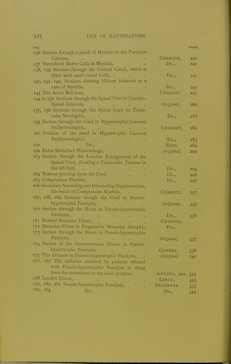 136 Section through a patch of Myelitis in the Posterior Column, ..... 137 Vacuolated Nerve Cells in Myelitis, 13S, 139 Sections through the Central Canal, which is filled with small round Cells, . 140, 141, 142, Sections showing Miliary Sclerosis in a case of Myelitis, .... 143 The Acute Bed-sore, .... 144 to 156 Sections through the Spinal Cord in Cerebro- spinal Sclerosis, .... 157, 158 Sections through the Spinal Cord in Tuber- cular Meningitis, .... 159 Section through the Cord in Hypertrophic Cervical Pachymeningitis, .... 160 Position of the hand in Hypertrophic Cervical Pachymeningitis, .... 161 Do., 162 Extra-Medullary Hemorrhage, 163 Section through the Lumbar Enlargement of the Spinal Cord, showing a Tubercular Tumour in the left half, ..... 164 Tumour pressing upon the Cord, 165 Compression Myelitis, .... 166 Secondary Ascending and Descending Degenerations, the result of Compression Myelitis, 167, 16S, 169 Sections though the Cord in Pseudo- hypertrophic Paralysis, 170 Section through the Heart in Pseudo-hypertrophic Paralysis, ..... 171 Normal Muscular Fibres, .... 172 Muscular Fibres in Progressive Muscular Atrophy, 173 Section through the Heart in Pseudo-hypertrophic Paralysis, ..... 174 Section of the Gastrocnemius Muscle in Pseudo- hypertrophic Paralysis, 175 The Attitude in Pseudo-hypertrophic Paralysis, 176, 177 The attitudes assumed by patients affected with Pseudo-hypertrophic Paralysis in rising from the recumbent to the erect position, 178 Leech's Trocar, 179- !8o, 181 Pseudo-hypertrophic Paralysis, . 182, 183 Do., Charcot, 241 Do., 241 Do., 241 Do., 241 Charcot, Original, 2€>2 Do., 272 Charcot, 282 Do., 283 Ross, 284 Original, 292 Tin 294 Do., 296 Do., 296 Charcot, 297 (Jj'J O'J JJ/71 > > - Do., 336 Charcot, Do., Original, 337 GoWERS, 338 Original, 340 GOWERS, 342, 343 Leech, 343 Duchenne 335 Do., 344