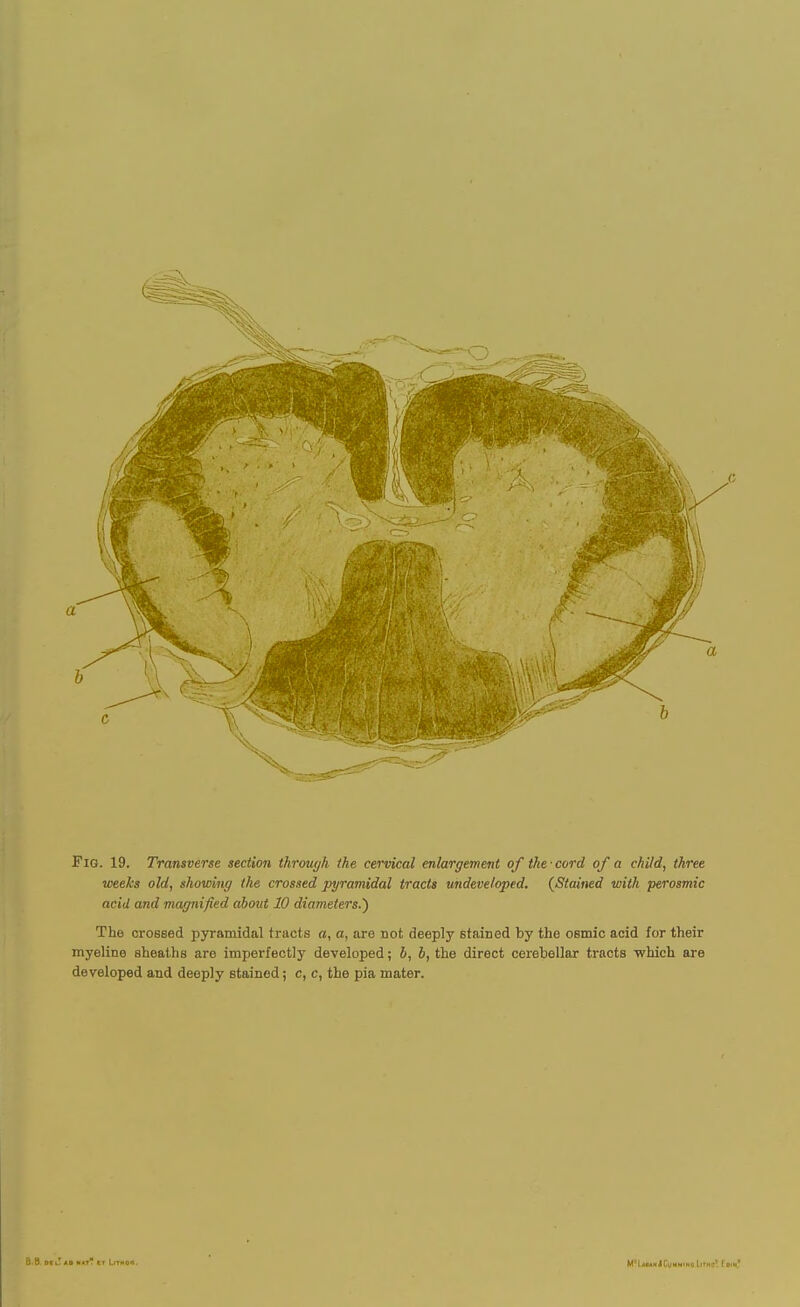 weeks old, showing the crossed pyramidal tracts undeveloped. {Stained with perosmic acid and magnified about 10 diameters.') The crosBed pyramidal tracts a, a, are not deeply stained by the osmic acid for their myeline sheaths are imperfectly developed; b, b, the direct cerebellar tracts which are developed and deeply stained; c, c, the pia mater. B-B Dl. *D  LiTHOfl.