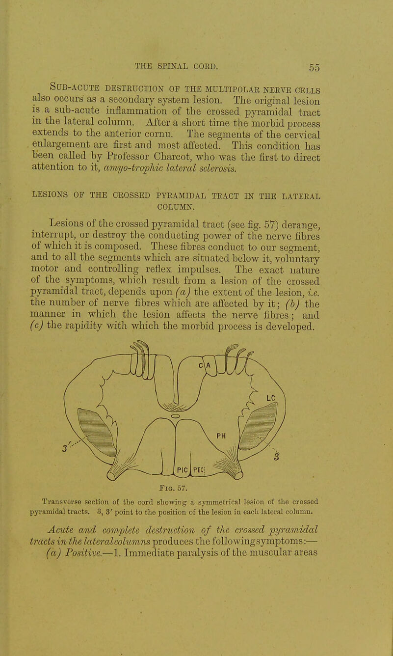 Sub-ACUTE DESTRUCTION of the multipolar nerve cells also occurs' as a secondary system lesion. The original lesion is a sub-acute inflammation of the crossed pyramidal tract in the lateral column. After a short time the morbid process extends to the anterior cornu. The segments of the cervical enlargement are first and most affected. This condition has been called by Professor Charcot, who was the first to direct attention to it, amyo-trophic lateral sclerosis. lesions of the crossed pyramidal tract in the lateral COLUMN. Lesions of the crossed pyramidal tract (see fig. 57) derange, interrupt, or destroy the conducting power of the nerve fibres of which it is composed. These fibres conduct to our segment, and to all the segments which are situated below it, voluntary motor and controlling reflex impulses. The exact nature of the symptoms, which result from a lesion of the crossed pyramidal tract, depends upon (a) the extent of the lesion, i.e. the number of nerve fibres which are affected by it; (b) the manner in which the lesion affects the nerve fibres; and (c) the rapidity with which the morbid process is developed. Fig. 57. Transverse section of the cord showing a symmetrical lesion of the crossed pyramidal tracts. 3, 3' point to tho position of the lesion in each lateral column. Acute and complete destruction of the crossed pyramidal tracts in the lateral columns produces the followingsymptoms:— (a) Positive.—1. Immediate paralysis of the muscular areas