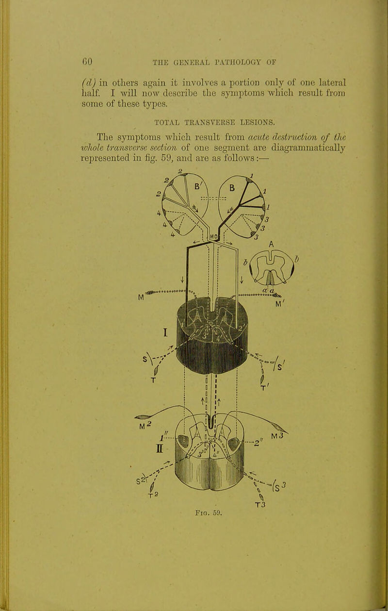(d) in others again it involves a portion only of one Literal half. I Avill now describe the symptoms which result from some of these types. TOTAL TRANSVERSE LESIONS. The symptoms which result from acute destruction of the vjhole transverse section of one segment are diagrammatically represented in fig. 59, and are as follows:—