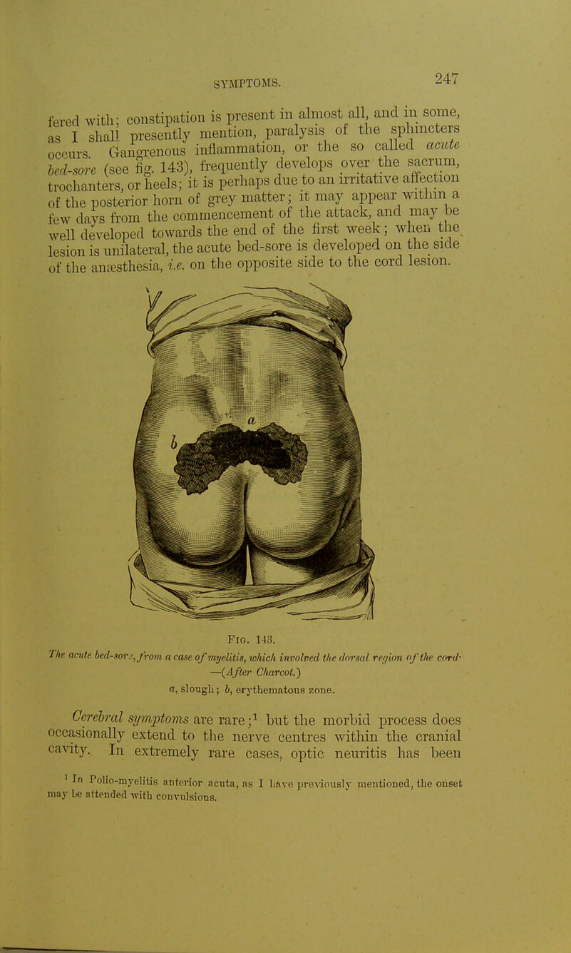 fered with; constipation is present in almost all and m some, as I shall presently mention, paralysis of the sphincters occurs Gangrenous inflammation, or the so called acute l,n/-sore (see fig. 143), frequently develops over the sacrum, trochanters, or heels; it is perhaps due to an irritative affection of the posterior horn of grey matter; it may appear within a few days from the commencement of the attack, and may be well developed towards the end of the first week; when the lesion is unilateral, the acute bed-sore is developed on the side of the anesthesia, i.e. on the opposite side to the cord lesion. Fig. 143. The actite bed-sor.;,from a case of myelitis, which involved the dorsal region of the cord- —(After Charcot.') a, slough; b, erythematous zone. Cerebral symptoms are rare;1 hut the morbid process does occasionally extend to the nerve centres within the cranial cavity. In extremely rare cases, optic neuritis has been 1 In Tolio-myelitis anterior acuta, as I have previously mentioned, the onset may be attended with convulsions.