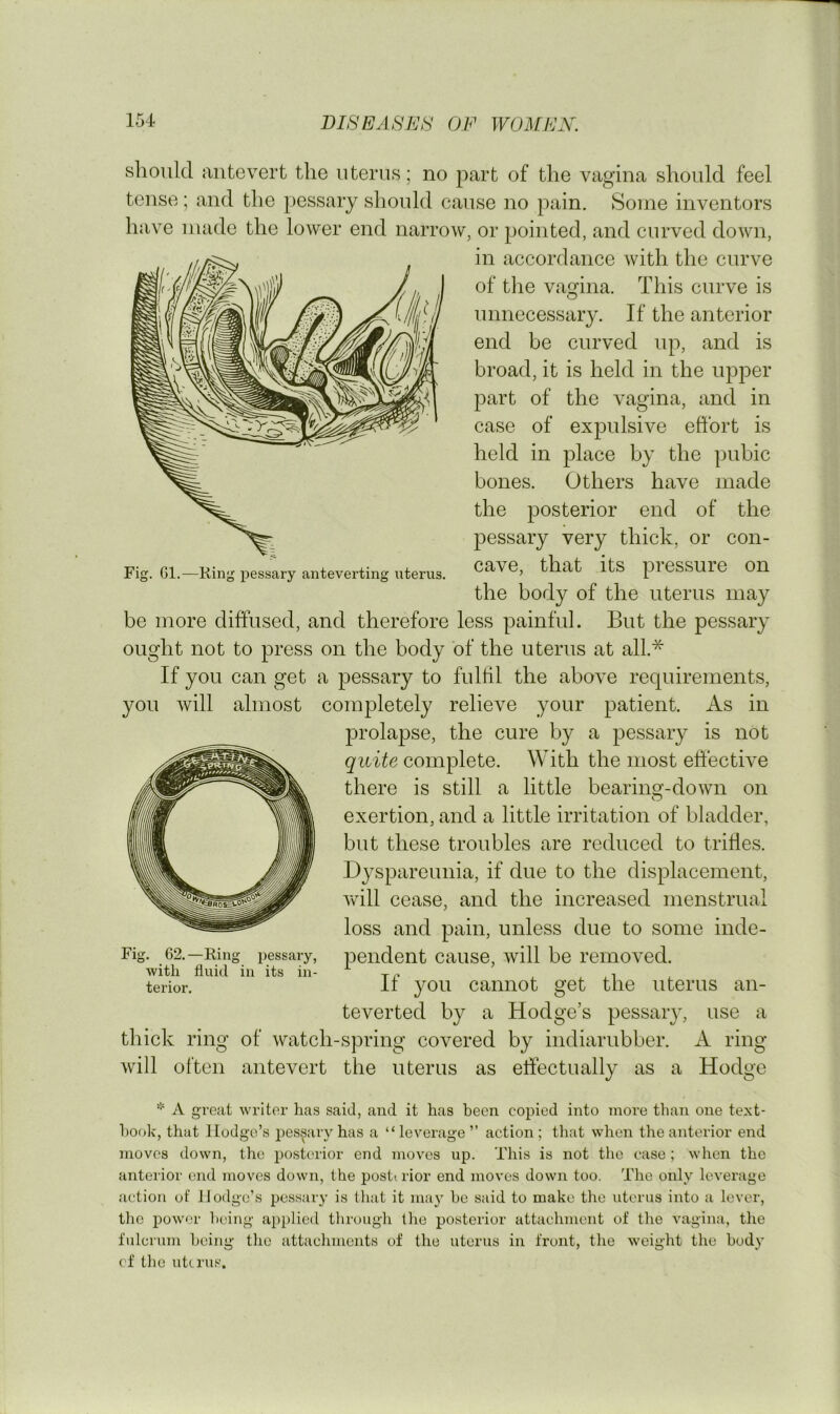 Fig. Gl.—King pessary anteverting uterus. should ante vert the uterus; no part of the vagina should feel tense; and the pessary should cause no pain. Some inventors have made the lower end narrow, or pointed, and curved down, in accordance with the curve of the vagina. This curve is O unnecessary. If the anterior end be curved up, and is broad, it is held in the upper part of the vagina, and in case of expulsive effort is held in place by the pubic bones. Others have made the posterior end of the pessary very thick, or con- cave, that its pressure on the body of the uterus may be more diffused, and therefore less painful. But the pessary ought not to press on the body of the uterus at all.* If you can get a pessary to fultil the above requirements, you will almost completely relieve your patient. As in prolapse, the cure by a pessary is not quite complete. With the most eftective there is still a little bearinsf-down on exertion, and a little irritation of bladder, but these troubles are reduced to trifles. Dyspareunia, if due to the displacement, Avill cease, and the increased menstrual loss and pain, unless due to some inde- pendent cause, will be removed. If you cannot get the uterus an- teverted by a Hodge’s pessary, use a thick ring of watch-spring covered by indiarubber. A ring will often antevert the uterus as effectually as a Hodge Fig. 62. —Ring pessary, witli fluid in its in- terior. A great writer has said, and it has been copied into more than one text- book, that Hodge’s pessary has a “ leverage ” action ; that when the anterior end moves down, the post('rior end moves up. This is not the case; when the anterior end moves down, the posterior end moves down too. The only leverage action of Hodge’s pessary is that it ma} he said to make the iiterus into a lever, the pow'or being applied through the posterior attachment of the vagina, the fulcrum being the attachments of the uterus in front, the weight the body cf the uterus.