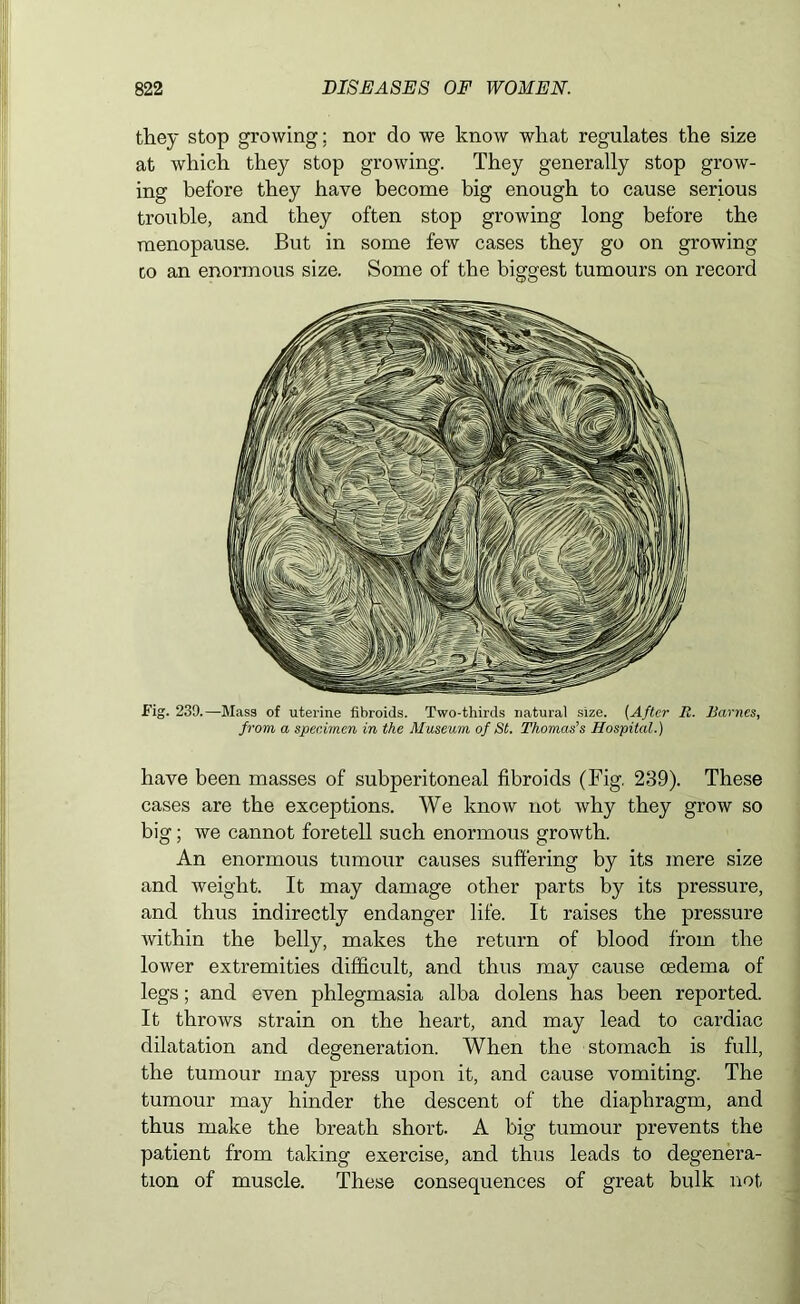 they stop growing; nor do we know what regulates the size at which they stop growing. They generally stop grow- ing before they have become big enough to cause serious trouble, and they often stop growing long before the menopause. But in some few cases they go on growing to an enormous size. Some of the biggest tumours on record Fig. 239.—Mass of uterine fibroids. Two-thirds natural size. (After R. Barnes, from a specimen in the Museum of St. Thomas's Hospital.) have been masses of subperitoneal fibroids (Fig. 239). These cases are the exceptions. We know not why they grow so big; we cannot foretell such enormous growth. An enormous tumour causes suffering by its mere size and weight. It may damage other parts by its pressure, and thus indirectly endanger life. It raises the pressure within the belly, makes the return of blood from the lower extremities difficult, and thus may cause oedema of legs; and even phlegmasia alba dolens has been reported. It throws strain on the heart, and may lead to cardiac dilatation and degeneration. When the stomach is full, the tumour may press upon it, and cause vomiting. The tumour may hinder the descent of the diaphragm, and thus make the breath short. A big tumour prevents the patient from taking exercise, and thus leads to degenera- tion of muscle. These consequences of great bulk not