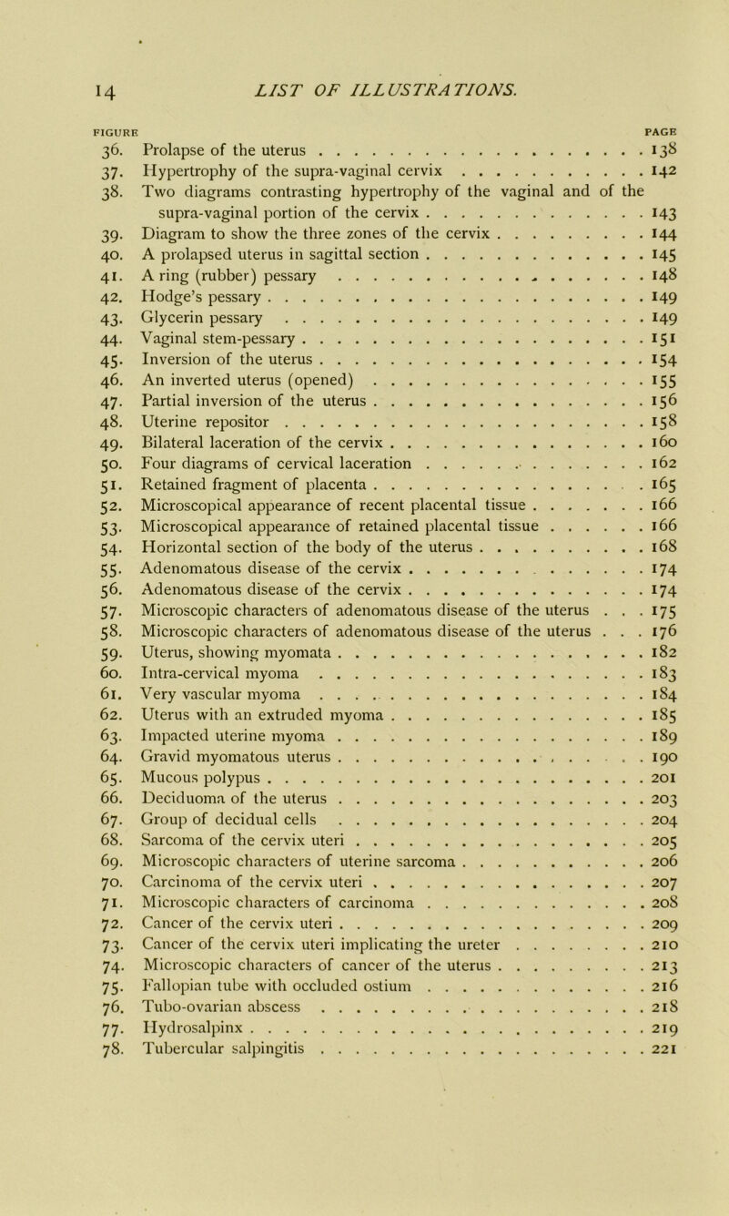 FIGURE PAGE 36. Prolapse of the uterus 138 37. Hypertrophy of the supra-vaginal cervix 142 38. Two diagrams contrasting hypertrophy of the vaginal and of the supra-vaginal portion of the cervix 143 39. Diagram to show the three zones of the cervix 144 40. A prolapsed uterus in sagittal section 145 41. A ring (rubber) pessary 148 42. Hodge’s pessary 149 43. Glycerin pessary 149 44. Vaginal stem-pessary 151 45- Inversion of the uterus 154 46. An inverted uterus (opened) 155 47. Partial inversion of the uterus 156 48. Uterine repositor 158 49. Bilateral laceration of the cervix 160 50. Four diagrams of cervical laceration 162 51. Retained fragment of placenta . 165 52. Microscopical appearance of recent placental tissue 166 53. Microscopical appearance of retained placental tissue 166 54. Horizontal section of the body of the uterus 168 55. Adenomatous disease of the cervix 174 56. Adenomatous disease of the cervix 174 57. Microscopic characters of adenomatous disease of the uterus . . .175 58. Microscopic characters of adenomatous disease of the uterus . . .176 59. Uterus, showing myomata 182 60. Intra-cervical myoma 183 61. Very vascular myoma 184 62. Uterus with an extruded myoma 185 63. Impacted uterine myoma 189 64. Gravid myomatous uterus 190 65. Mucous polypus 201 66. Deciduoma of the uterus 203 67. Group of decidual cells 204 68. Sarcoma of the cervix uteri 205 69. Microscopic characters of uterine sarcoma 206 70. Carcinoma of the cervix uteri 207 71. Microscopic characters of carcinoma 208 72. Cancer of the cervix uteri 209 73. Cancer of the cervix uteri implicating the ureter 210 74. Microscopic characters of cancer of the uterus 213 75. Fallopian tube with occluded ostium 216 76. Tubo-ovarian abscess 218 77. Hydrosalpinx 219 78. Tubercular salpingitis 221