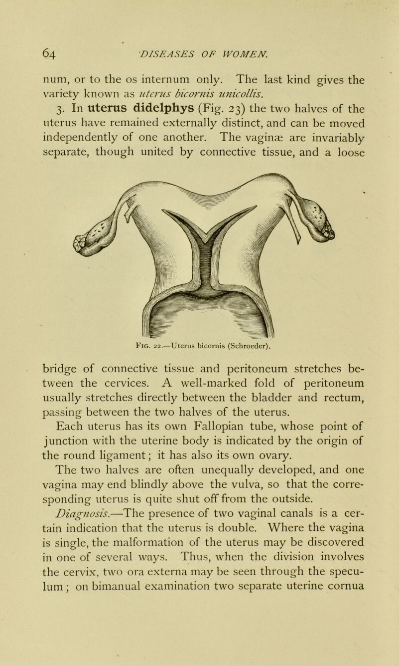 num, or to the os internum only. The last kind gives the variety known as uterus bicornis unicollis. 3. In uterus didelphys (Fig. 23) the two halves of the uterus have remained externally distinct, and can be moved independently of one another. The vaginae are invariably separate, though united by connective tissue, and a loose Fig. 22.—Uterus bicornis (Schroeder). bridge of connective tissue and peritoneum stretches be- tween the cervices. A well-marked fold of peritoneum usually stretches directly between the bladder and rectum, passing between the two halves of the uterus. Each uterus has its own Fallopian tube, whose point of junction with the uterine body is indicated by the origin of the round ligament; it has also its own ovary. The two halves are often unequally developed, and one vagina may end blindly above the vulva, so that the corre- sponding uterus is quite shut off from the outside. Diagnosis.—The presence of two vaginal canals is a cer- tain indication that the uterus is double. Where the vagina is single, the malformation of the uterus may be discovered in one of several ways. Thus, when the division involves the cervix, two ora externa may be seen through the specu- lum ; on bimanual examination two separate uterine cornua