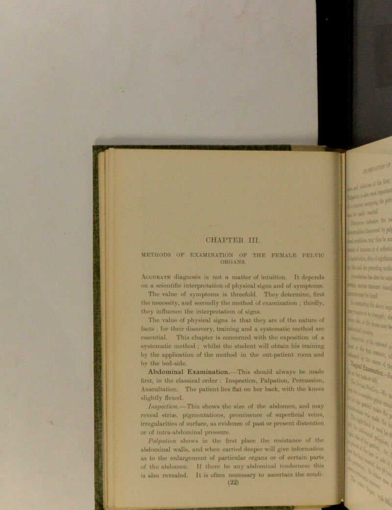 CHAPTER TIL METHODS OF EXAMINATION OP THE FEMALE PELVIC ORGANS. Accurate diagnosis is not a matter of intuition. It depends on a scientific interpretation of physical signs and of symptoms. The value of symptoms is threefold. They determine, first the necessity, and secondly the method of examination ; thirdly, they influence the interpretation of signs. The value of physical signs is that they are of the nature of facts ; for their discovery, training and a systematic metho<l are essential. This chapter is concerned with the exposition of a systematic method ; whilst the student will obtain his training l)y the application of the method in the out-patient room and l)y the l)ed-side. Abdominal Examination.—This should always be made first, in the classical order ; Inspection, Palpation, Percussion, Auscultation. The patient lies flat on her back, with the knees slightly fle.xed. [iispection.—This shows the size of the alnlomen, and may reveal striie, pigmentations, prominence of superficial veins, irregularities of surface, as evidence of past or present distention or of intra-abdominal pressure. Palpation shows in the first place the resistance of the abdominal walls, and when carried deeper will give information as to the enlargement of particular organs or of certain parts of the al)domen. If there he any abdominal tenderness this is also revealed. It is often necessary to ascertain the condi- (22) I j |j iS( ” } [• - I ft,,... iaiwies ^ “ ibd'Oiiiip' discovfit<i b\ pjl[ iiliODS MV litti bf IM iyisi aKjiiK. bv jL Hi tal hi. Nf55 ,**'^**0U