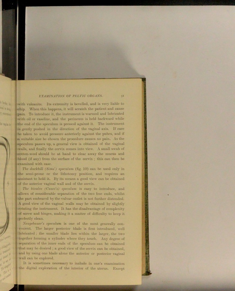 1’Avith vulcanite. Its extremity is bevelled, and is very lialde to ichip. When this happens, it will scratch the patient and cause I [pain. To introduce it, the instrument is warmed and lulnlcated uvith oil or vaseline, and the perineum is held backward while :the end of the speculum is pressed against it. The insti'ument !’is gently pushed in the direction of the vaginal axis. If care fbe taken to avoid pressure anteriorly against the pubes, and if ,ia suitable size be chosen the procedure causes no pain. .-\s the -ispeculum passes up, a general view is obtained of the vaginal -walls, and finally the cervix comes into view. A small swal) of i-cotton-wool should be at hand to clear away the mucus and 1 ildood (if any) from the surface of the cervix ; this can then be I examined with ease. The duckbill (Sims’) speculum (fig. 10) can be used only in :the semi-prone or the lithotomy position, and requires an jassistant to hold it. By its means a good view can be ol)tained of the anterior vaginal wall and of the cervix. The bivalve (Cusco's) speculum is easy to introduce, and allows of considerable separation of the two free ends, whilst tthe part embraced by the vulvar outlet is not further distended. A good view of the vaginal walls may be obtained by slightly ■1 rotating the instrument. It has the disadvantage of complexity of screw and hinges, making it a matter of difficulty to keep it [perfectly clean. Xeugebauer’s speculum is one of the most generally con- 'venient. The larger posterior blade is first introduced, well llul)ricated ; the smaller blade lies within the larger, the two 1 together forming a cylinder where they touch. Any degree of < -separation of the inner ends of the speculum can be obtained tthat may be desired ; a good view of the cervix can be obtained, and by using one blade alone the anterior or posteiior vaginal ■wall can Ije explored. It is sometimes necessary to include in one’s examination ! ithe digital exploration of the interior of the uterus. Except