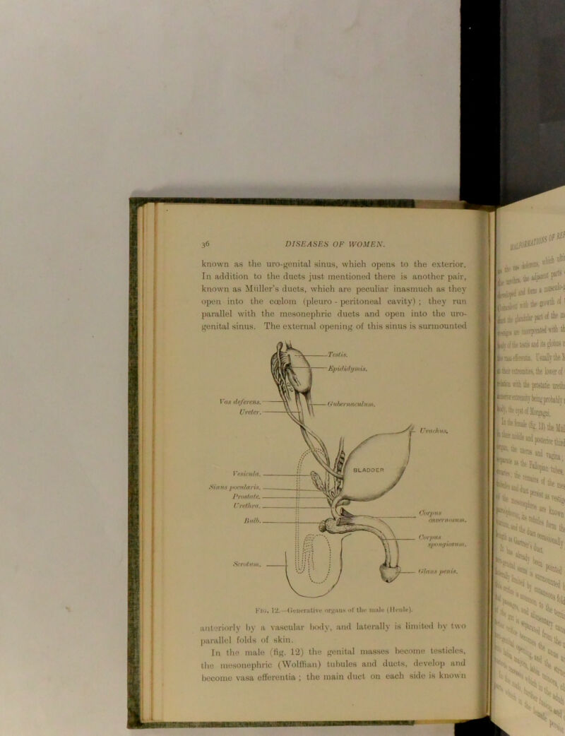 known as the uro-^enital sinus, which opens to the exterior. In addition to the ducts just mentioned there is another pair, known as Muller’s ducts, which are peculiar inasmuch as they open into the ccelom (pleuro - peritoneal cavity) ; they run parallel with the mesonephric ducts and open into the uro- f'enital sinus. The external opening of this sinus is surmounted Klii. I'i.—(tviuTiitivi- or^iiMs of tlic m;ilf (lliMilc)- anteriorly l>y a vasculai’ laxly, and laterally is limited hy two parallel folds of skin. In the male (fig. 12) the genital masses become testicles, the mesonephric (WolHian) tubules and ducts, develop and become vasa ell'erentia ; the main duct on each side is known I **«*■•'*'* ■}* fMt ol llie» inoofpoBtfti «illi A ivivol lit totjs and ils lotas n li'tjiieimia. UaallnlieJl tlistexBeniities.tlie lower of' ►MOB «iili ie prosanc nretlu ;‘^*®»le%13|tlitynl 7^««posterionhiRi 'ta Bfcnis ‘^'Nstas, T'^n'^N 'Mr,, ‘tiL ’'li ‘*0(1, ■%%