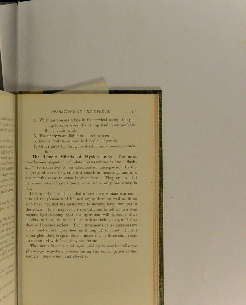 When an abscess arises in the cervical stump, the pus, a ligature, or even the stump itself may perfoi'ate the bladder wall. The ureters are liable to be cut or torn. One or both have been included in ligatures. 7. Or irritated by being involved in inflammatory exuda- tion. The Remote Effects of Hysterectomy.—The most troublesome sequel of complete hysterectomy is the “ flush- ing ” so indicative of an accentuated menopause. In the majority of cases they rapidly diminish in frequency, and in a few months cease to cause inconvenience. Thej- are avoided by conservative hysterectomy even when only one ovary is left. It is clearly established that a wombless woman can enter into all the pleasures of life and enjoy them as well as those who have not had the misfortune to develop large tumours in the pelvis. It is, moreover, a cowardly act to tell women who require hysterectomy that the operation will increase their liability to insanity, cause them to lose their voices, and that they will become sexless. Such statements cau.se unnecessary alarm, and inflict upon them much anguish of mind, w’hich it is our plain duty to spare them ; moreover, as these statements do not accord with facts, they are untrue. The uterus is not a vital organ, and its removal entails two physiologic sequelaj in women during the sexual period of life, namely, amenorrhcea and sterility. r -1