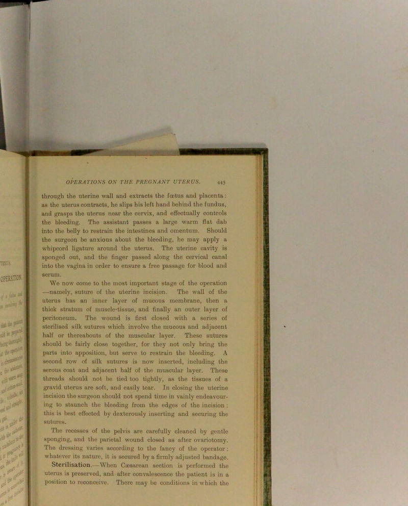 thi-ough the uterine wall and extracts the foetus and placenta: as the uterus contracts, he slips his left hand behind the fundus, and grasps the uterus near the cervix, and effectually controls the bleeding. The assistant passes a large warm flat dab into the belly to restrain the intestines and omentum. Should the surgeon be anxious about the bleeding, he may apply a whipcord ligature around the uterus. The uterine cavity is sponged out, and the finger passed along the cervical canal into the vagina in order to ensure a free passage for blood and serum. We now come to the most important stage of the operation —namely, suture of the uterine incision. The wall of the uterus has an inner layer of mucous membrane, then a thick stratum of muscle-tissue, and finally an outer layer of peritoneum. The wound is first closed with a series of sterilised silk sutures which involve the mucous and adjacent half or thereabouts of the muscular layer. These sutures should be fairly close together, for they not only bring the parts into apposition, but serve to restrain the bleeding. A second row of silk sutures is now inserted, including the serous coat and adjacent half of the muscular layer. These threads should not be tied too tightly, as the tissues of a gravid uterus are soft, and easily tear. In closing the uterine incision the surgeon should not spend time in vainly endeavour- ing to staunch the bleeding from the edges of the incision : this is best effected by dexterously inserting and securing the sutures. The recesses of the pelvis are carefully cleaned by gentle sponging, and the parietal wound closed as after ovariotomy. The dressing varies according to the fancy of the operator : whatever its nature, it is secured by a firmly adjusted bandage. Sterilisation.—When Cajsarean section is performed the uterus is preserved, and after convalescence the patient is in a position to reconceive. There may be conditions in which the